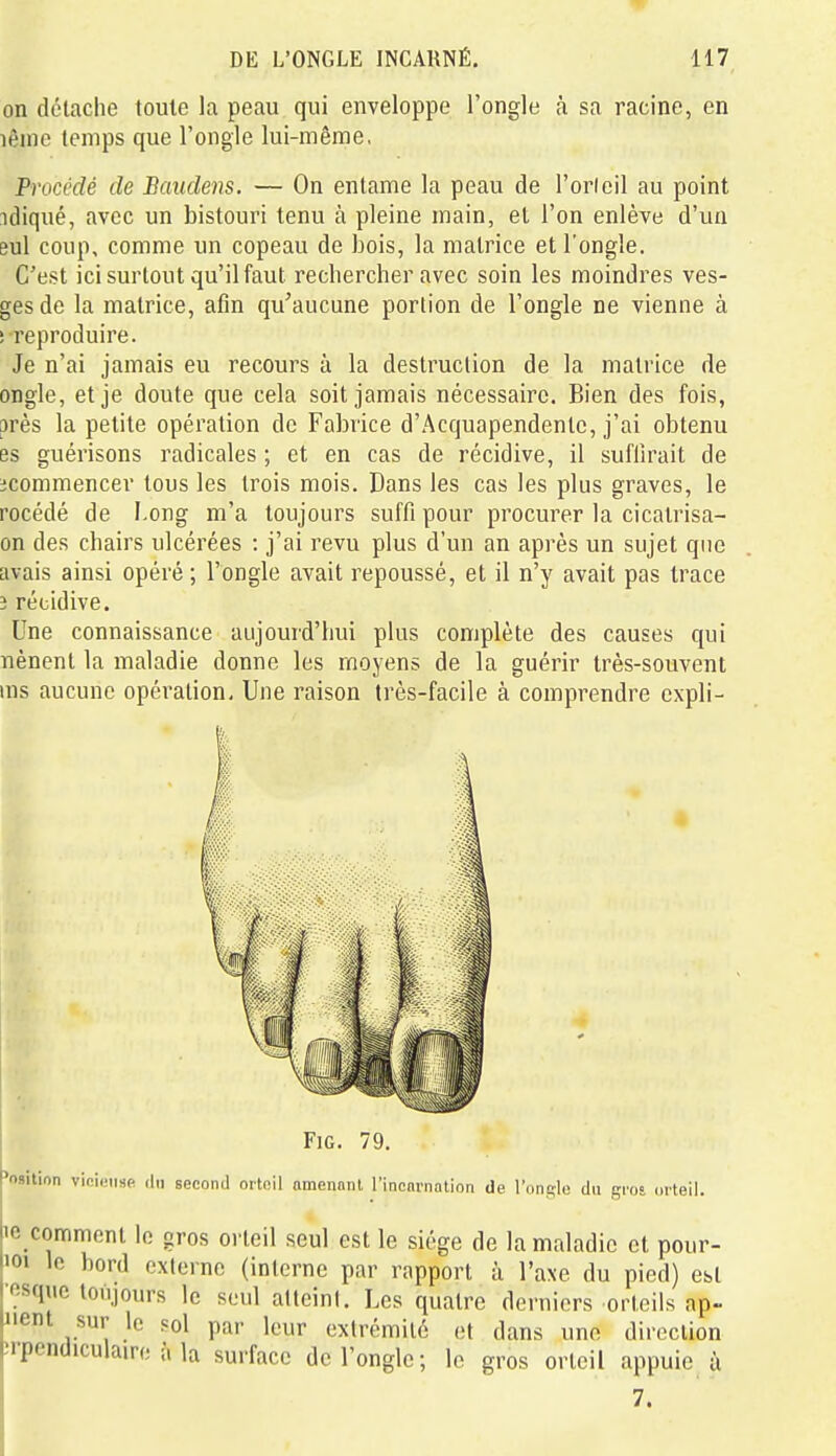 on détache toute la peau qui enveloppe l'ongle h sa racine, en lênie temps que l'ongle lui-même, Procédé de Baudens. — On entame la peau de l'oricil au point idiqué, avec un bistouri tenu à pleine main, et l'on enlève d'un Bul coup, comme un copeau de bois, la matrice et l'ongle. C'est ici surtout qu'il faut rechercher avec soin les moindres ves- gesde la matrice, afin qu'aucune portion de l'ongle ne vienne à i reproduire. Je n'ai jamais eu recours à la destruction de la matrice de ongle, et je doute que cela soit jamais nécessaire. Bien des fois, près la petite opération de Fabrice d'.Acquapendentc, j'ai obtenu es guérisons radicales ; et en cas de récidive, il suffirait de ^commencer tous les trois mois. Dans les cas les plus graves, le rocédé de Long m'a toujours suffi pour procurer la cicatrisa- on des chairs ulcérées : j'ai revu plus d'un an après un sujet que avais ainsi opéré; l'ongle avait repoussé, et il n'y avait pas trace 3 récidive. Une connaissance aujourd'hui plus complète des causes qui nènent la maladie donne les moyens de la guérir très-souvent ms aucune opération. Une raison très-facile à comprendre expli- FiG. 79, 'osilion vieii.iHp iIm second orteil nmennnl l'incnriiation de l'onslo du gros orteil. 'c comment le gros orteil seul est le siège de la maladie et pour- '>oi le bord exlernc (interne par rapport à l'axe du pied) est osquc toujours le seul attcinl. Les quatre derniers orteils ap- Mient sur le «ol par leur extrémité et dans une direction (.'rpcndiculaire à la surface de l'ongle; le gros orteil appuie ù 7.