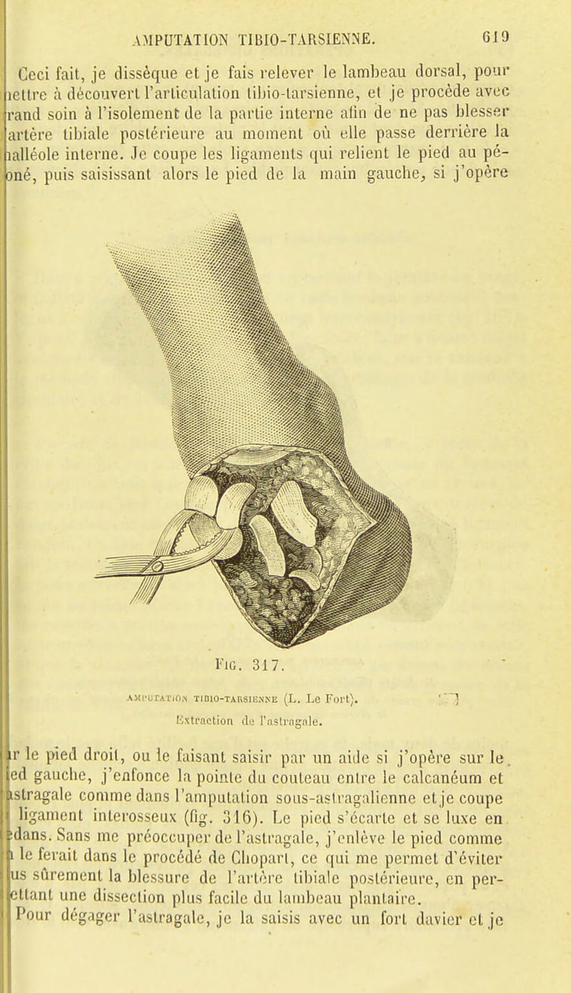 Ceci fait, je dissèque et je fais relever le lambeau dorsal, pour icKre à découvert l'arliculation libio-tarsienne, et je procède avec rand soin à l'isolement de la partie interne afin de ne pas blesser artère tibiale postérieure au moment où elle passe derrière la lalléole interne. Je coupe les ligaments qui relient le pied au pé- oné, puis saisissant alors le pied de la main gauche^ si j'opère riG. 317. Aiii'urATiON TiDio-TABSiKNiNE (L. Lo Fort). Uxtraotion du l'nstrngnle. ir le pied droit, ou le faisant saisir par un aide si j'opère sur le. led gauche, j'enfonce la pointe du couteau entre le calcanéum et ■istragale comme dans l'amputation sons-astragalienne et je coupe ligament inlcrosseux (fig. 316). Le pied s'écarte et se luxe en ' idans. Sans me préoccuper de l'astragale, j'enlève le pied comme i le ferait dans le procédé de Clioparl, ce qui me permet d'éviter us sûrement la blessure de l'artère tibiale postérieure, en per- ettant une dissection plus facile du lambeau plantaire. Pour dégager l'astragale, je la saisis avec un fort davior et je