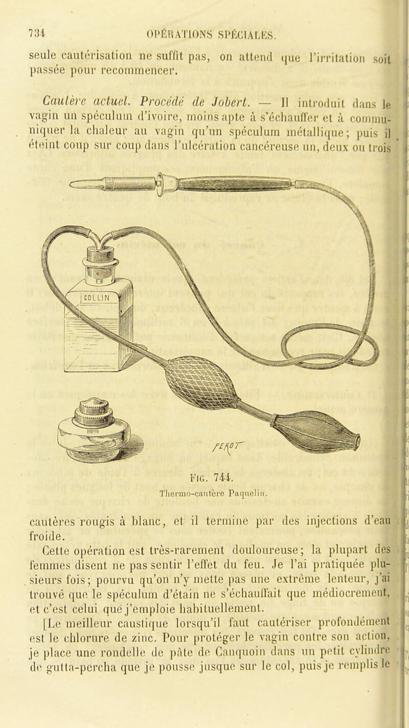 seule cautérisation ne suffit pas, on attend (jue l'irritation soit passée pour recommencer. Cautère actuel. Procédé de Jobert. — 11 introduit dans le vagin un spéculum d'ivoire, moins apte à s'échauffer et à commu- niquer la chaleur au vagin qu'un spéculum métallique; puis il éteint coup sur coup dans l'ulcération cancéreuse un, deux ou trois l''iG. 744. Tliermo-eaiitèi'e Paqiiel i n. . à cautères rougis à hianc, et il termine par des injections d'eati|B| froide. .jm Cette opération est très-rarement douloureuse ; la plupart d^tf^ femmes disent ne pas sentir l'effet du feu. Je l'ai pratiquée plu-^ sieurs fois ; pourvu qu'on n'y nielle pas une extrême lenteur, j'ai trouvé que le spéculum d'étain ne s'échauffait que médiocrement, et c'est celui que j'emploie liabituelleraenl. [Le meilleur causiique lorsqu'il faut cautériser profondément ,i est le chlorure de zinc. Pour j)roléger le vagin contre son action, w je place une rondelle de pâte do Canquoin dans un petit cylindre • de gulta-percha que je pousse jusque sur le col, puis je remplis le •