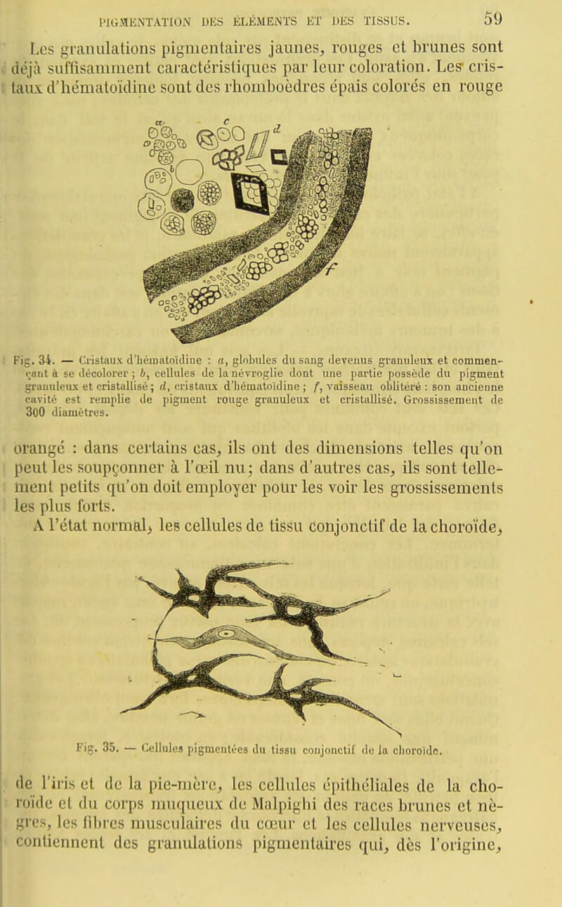 Les granulations pigmentaires jaunes, rouges et brunes sont déjà suffisamuaent caractéristiques par leur coloration. Les' cris- taux d'hématoïdine sont des rhomboèdres épais colorés en rouge Fig. 34. — Cristaux d'hématouliue : a, globules du sang ilevcuus granuleux et commen- <;arit ù se ilécolorer ; b, cellules de la névroglie dont une partie possède du pigment granuleux et cristallisé; ri, cristaux d'iiématoidine ; f, vaisseau oblitéré : son ancienne cavité est remplie de pigment rouge gi'anuleux et cristallisé. Grossissement de 300 diamètres. orangé : dans certtiins cas, ils ont des dimensions telles qu'on peut les soupçonner à l'œil nuj dans d'autres cas, ils sont telle- ment petits qu'on doit employer polir les voir les grossissements les plus forts. A l'état normal^ les cellules de tissu conjonctif de la choroïde, Fig. 35. — Cellules pigmentées du tissu conjonctif de la choroïde. de l'iris et de la pic-mère, les cellules épithéliales de la cho- roïde et du corps muqueux de Malpighi des races brunes et nè- gres, les fibres musculaires du cœur et les cellules nerveuses, contiennent des granulations pigmentaires qui, dès l'origine.