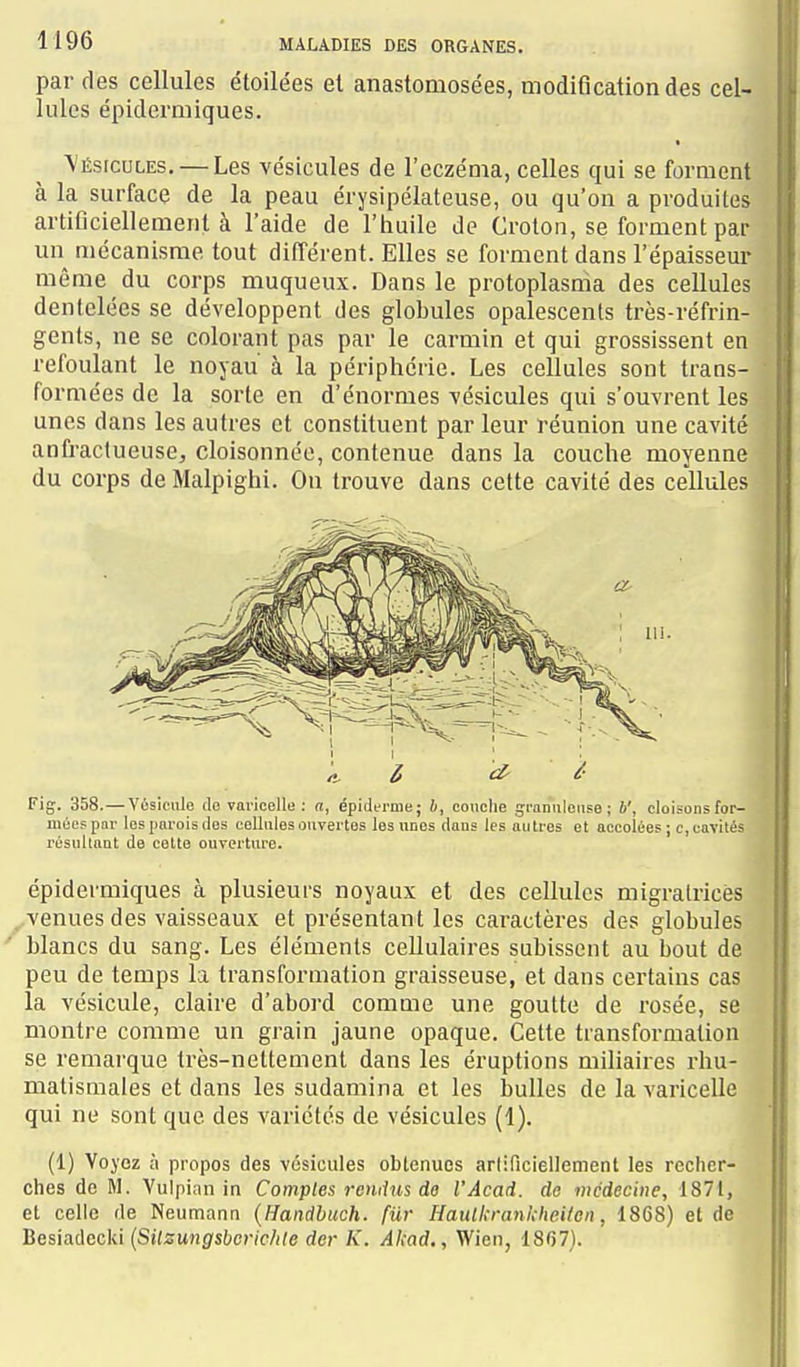 par des cellules étoilées el anastomosées, modification des cel- lules épidermiques. Vésicules, — Les vésicules de l'eczéma, celles qui se forment à la surface de la peau érysipélateuse, ou qu'on a produites artificiellement à l'aide de l'huile de Croton, se forment par un mécanisme tout différent. Elles se forment dans l'épaisseur même du corps muqueux. Dans le protoplasma des cellules dentelées se développent des globules opalescents très-réfrin- gents, ne se colorant pas par le carmin et qui grossissent en refoulant le noyau à la périphérie. Les cellules sont trans- formées de la sorte en d'énormes vésicules qui s'ouvrent les unes dans les autres et constituent par leur réunion une cavité anfraclueuse, cloisonnée, contenue dans la couche moyenne du corps de Malpighi. On trouve dans cette cavité des cellules Fig. 358.—Vùsiciile do varicelle : a, épiderme; 6, couche gronnloiise ; V, cloisons for- mées pai- les parois des cellules ouvertes les unes dans les autres et accolées ; c, cavités résultant de cette ouverture. épidermiques à plusieurs noyaux et des cellules migratrices ^venues des vaisseaux et présentant les caractères des globules blancs du sang. Les éléments cellulaires subissent au bout de peu de temps la transformation graisseuse, et dans certains cas la vésicule, claire d'abord comme une goutte de rosée, se montre comme un grain jaune opaque. Cette transformation se remarque très-nettement dans les éruptions miliaires rhu- matismales et dans les sudamina et les bulles de la varicelle qui ne sont que des variétés de vésicules (1). (1) Voyez à propos des vésicules obtenues arlificiellement les recher- ches de M. Vuipinn in Comptes 7-eniius de l'Âcad. de médecine, 1871, el celle rte Neumann {Handhuch. fiir Haulkrankheitcn, 1868) et de Besiadecki {Silsungsbcric/ile der K. Akad., Wien, 1867).