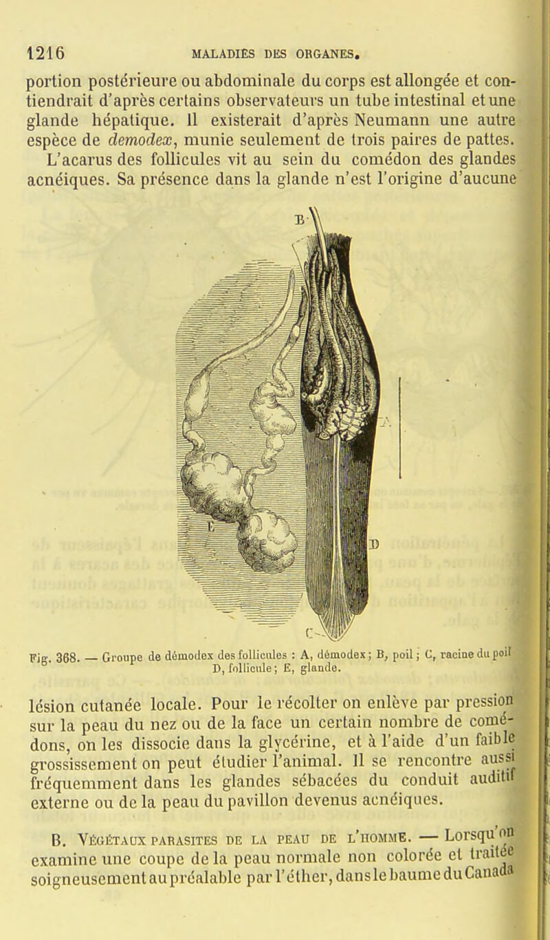 portion postérieure ou abdominale du corps est allongée et con- tiendrait d'après certains observateurs un tube intestinal et une glande hépatique. 11 existerait d'après Neumann une autre espèce de demodex, munie seulement de trois paires de pattes. L'acarus des follicules vit au sein du comédon des glandes acnéiques. Sa présence da.ns la glande n'est l'origine d'aucune Fie 368. Groupe de démodex des follicules  D, follicule ; E, A, démodex ; B, poil j G, racine du poit glande. i lésion cutanée locale. Pour le récolter on enlève par pression' sur la peau du nez ou de la face un certain nombre de comé- dons, Oïl les dissocie dans la glycérine, et à l'aide d'un faible gi-ossissement on peut étudier l'animal. Il se rencontre aussi fréquemment dans les glandes sébacées du conduit audit» externe ou de la peau du pavillon devenus acnéiques. ^ B, Végétaux parasites de la peau de l'homme. — Lorsqu'on examine une coupe de la peau normale non colorée et traitée soigneusement au préalable par l'éther, dans le baume du Canada