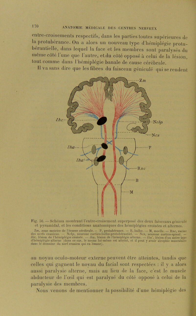 Fif,'. .'il). — 8clii‘ina mdiilraniroiiliMî-ci'oi.Sümonl suporpos(i dos doux faisceauxgônioulô cl pyramidal, ol. 1rs rondUions atialomi(|uos dos liémiplégios croisôos ot altornes. Zm, zoiii! inolricn ilo l’Ocorco cériiliralo. — I’, protuhi'Tniifie. — H, ljulbc. — M, niopllc. Une, rnciiio lies nerfs eriiiiieiis. — Ne6/), neurmie rorlieo-l.iill)0-proliil)(''rniiliol. — Nc«, neurone corlico-spinul. — Ikc, lésion (le riiéniipléf>'in croisée. — lha, lésion de riiéiniplégie allerno. — Hui', lésion d'un antre type d’héMiipléftie alterne (dans ce cas, le noyau lui-niéinc est atlcinl, et il jKuit y avoir atrojiliie niusenliiire dans le domaine ilu nerf crânien i|ui en émane). -\N.\TOMIE .MKDIC.VLE DES CENTRES NERVEU.K cnlre-croisemcnts respectifs, tlans les parties toutes supérieures dt; la protubérance. On a alors un nouveau type triiénupléj^ie protu- bérantielle, dans letjuel la face et les membres sont paralysés du même côté runc que l'autre, et du côté opposé à celui de la lésion, tout comme dans l’bémiplégie banale de cause cérébrale. Il va sans dire que les fibres du faisceau géniculé ({ui se rendent //Je- an noyau oculo-moteur (!.\terne peuvent être atteintes, tandis que celles qui f^agnent le noyau du facial sont respectées : il y a alors aussi jiaralysie alterne, mais au lieu de la face, c’est le muscle abducteur de l’œil ([ui est paralysé du coté opposé à celui de la paralysie des membres. Nous venons de mentionner la possibilité d’une bémiplégie des