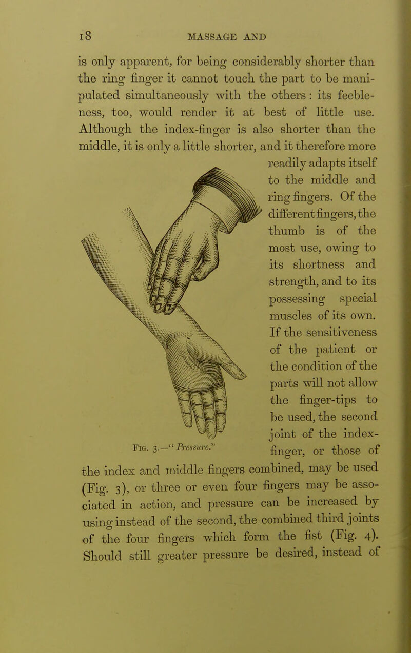 is only apparent, for being considerably shorter than the ring finger it cannot touch the part to be mani- pulated simultaneously with the others: its feeble- ness, too, would render it at best of little use. Although the index-finger is also shorter than the middle, it is only a little shorter, and it therefore more readily adapts itself to the middle and ring fingers. Of the different fingers, the thumb is of the most use, owing to its shortness and strength, and to its possessing special muscles of its own. If the sensitiveness of the patient or the condition of the parts will not allow the finger-tips to be used, the second joint of the index- finorer, or those of the index and middle fingers combined, may be used (Fig. 3), or three or even four fingers may be asso- ciated in action, and pressure can be increased by using instead of the second, the combined third joints of the four fingers which form the fist (Fig. 4). Should still greater pressure be desired, instead of