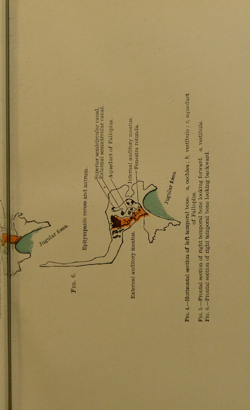 of Fallopius. Fig. 5.—Frontal section of right temporal hone looking forward, a, vestibule. Fig. 6.—Frontal section of right temporal bone looking backward.