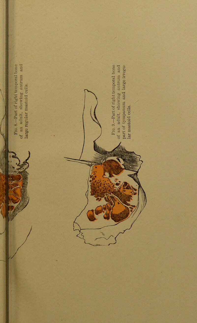 Fig. 8.—Part of right temporal bone of an adult, (showing antrum and large regular mastoid cells.