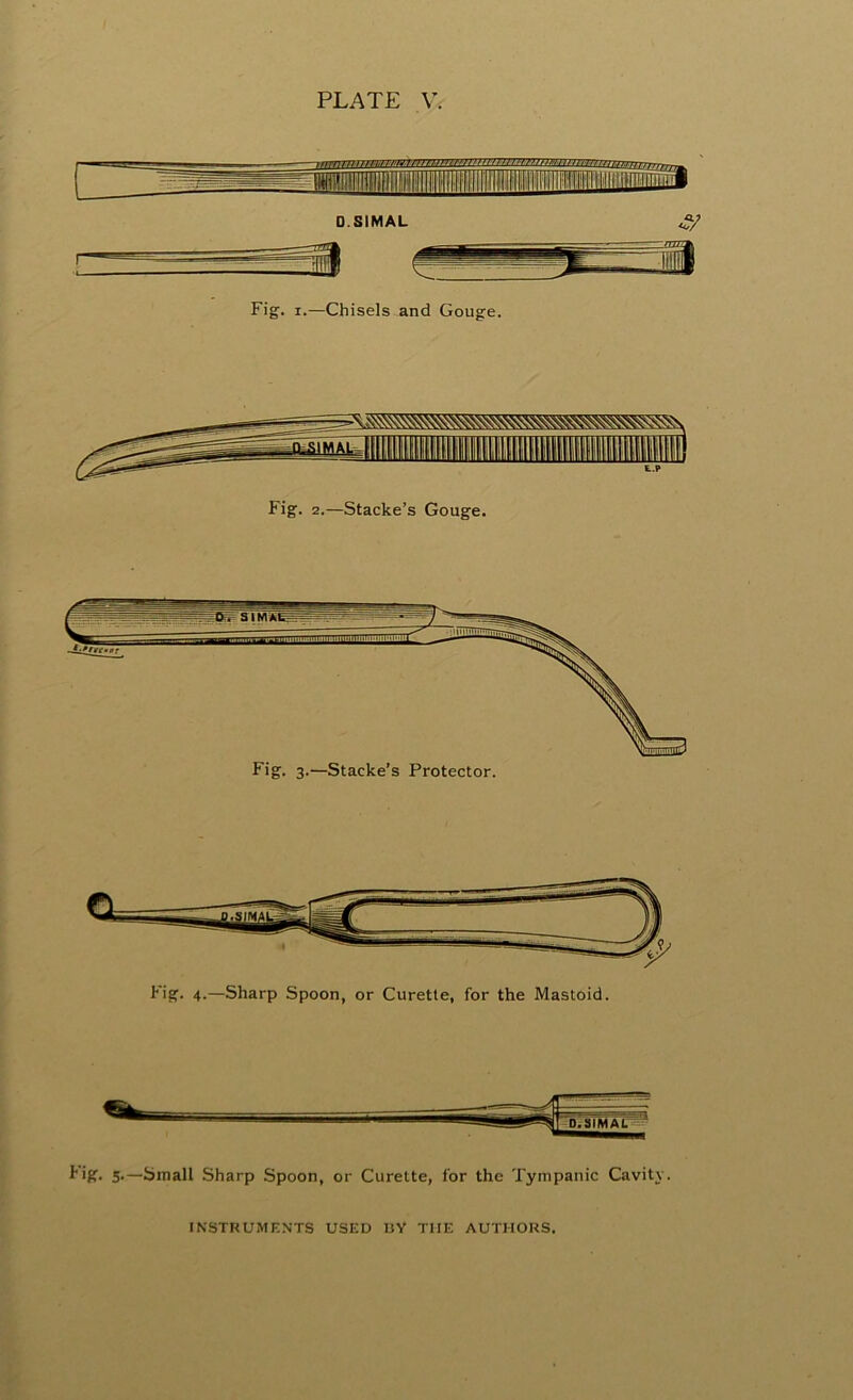 O.SIMAL Fig. i.—Chisels and Gouge. Fig. 2.—Stacke’s Gouge. Fig. 4.—Sharp Spoon, or Curette, for the Mastoid. iff. 5.—Small Sharp Spoon, or Curette, for the Tympanic Cavity. INSTRUMENTS USED IJY THE AUTHORS.
