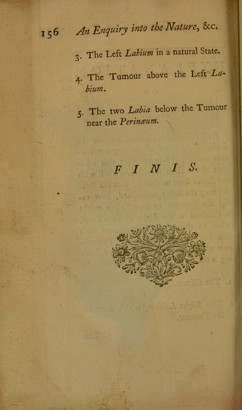 .H ^ The Left Labium in a natural State. 4. The Tumour above the Left La- bium. 5. The two Labia below the Tumour near the Perineum. \ FINIS\