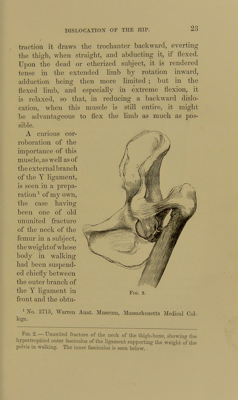 traction it draws the trochanter backward, everting the thigh, when straight, and abducting it, if flexed. Upon the dead or etherized subject, it is rendered tense in the extended limb by rotation inward, adduction being then more Imiited ; but in the flexed Umb, and especially in extreme flexion, it is relaxed, so that, in reducing a backward dislo- cation, when this muscle is still entire, it might be advantageous to flex the hmb as much as pos- sible. A curious cor- ^.■^^'^^^ the Y ligament in ^la. 2. front and the obtu- 1 No. 2715, Warren Anat. Museiun, Massachusetts Medical Col- lege. Fio. 2. — Ununited fracture of the neck of the thigh-bone, sliowing the hypertrophiecl outer fasciculus of the hgament supporting the weight of the pelvis in walking. The inner fasciculus is seen below, ■ roboration of the importance of this muscle, as well as of the external branch of the Y ligament, is seen in a prepa- ration^ of my own, the case having been one of old ununited fracture of the neck of the femur in a subject, the weightof whose body in walking had been suspend- ed chiefly between the outer branch of