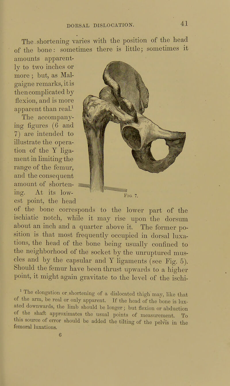 The. shortening varies with the position of the head of the bone: sometknes there is little; sometimes it amomits apparent- ly to two inches or more ; but, as Mal- gaigne remarks, it is then complicated by flexion, and is more apparent than real.^ The accompany- ing figures (6 and 7) are intended to illustrate the opera- tion of the Y hga- ment in limiting the range of the femur, and the consequent amount of shorten- ing. At its low- est point, the head of the bone corresponds to the lower part of the ischiatic notch, while it may rise upon the dorsum about an inch and a quarter above it. The former po- sition is that most frequently occupied in dorsal luxa- tions, the head of the bone being usually confined to the neighborhood of the socket by the unruptured mus- cles and by the capsular and Y ligaments (see Fig. 5). Should the femur have been thrust upwards to a higher pomt, it might again gravitate to the level of the ischi- ^ The elongation or.shortening of a dislocated thigh may, like that of the arm, be real or only apparent. If the head of the bone is Ivix- ated downwards, the limb should be longer; but flexion or abduction of the shaft approximates the usual points of measurement. To this source of error should be added the tilting of the pelvis in the femoral luxations. 6 Fig. 7.