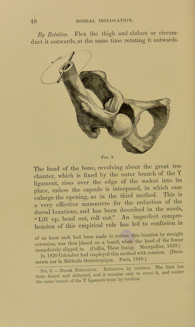 By Rotaiion. Flex the thigh and abduct or circum- duct it outwards, at the same time rotating it outwards. Fig. 9 The head of the bone, revolving about the great tro- chanter, which is fixed by the outer branch of the Y Hgament, rises over the edge of the socket mto its place, unless the capsule is interposed, in which case enlarge the opening, as in the third method. This is a very effective manoeuvre for the reduction of the dorsal luxations, and has been described m the words, «Lift up, bend out, roll out. An imperfect compre- hension of this empirical rule has led to confusion m of an hour each had been made to reduce this ^-l-^^^-^]^^;:^^ extension, was thus placed on a board, when the head of the femur immediately slipped in. (Collin, Thtee Inaug Montpeniei, 1833.) In 1830 Colombot had employed this method with rotation. (Uocu- ments sur la Methode Osteotropigue. Paris, 1840.) been flexed and abducted, and it remains only to evert it, and render the outer branch of the Y hgament tense by rotation.