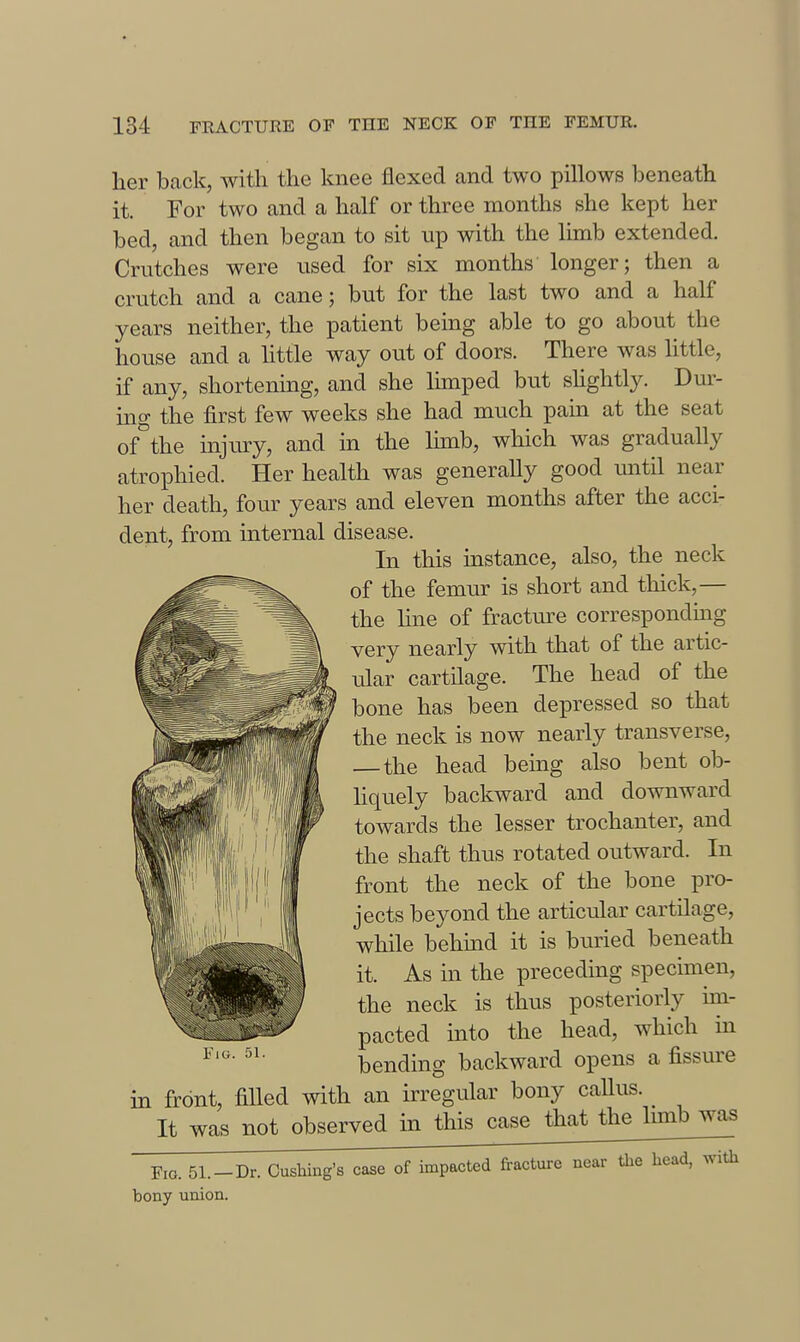 her back, with the knee flexed and two pillows beneath it. For two and a half or three months she kept her bed, and then began to sit up with the limb extended. Crutches were used for six months longer; then a crutch and a cane; but for the last two and a half years neither, the patient being able to go about the house and a little way out of doors. There was little, if any, shortening, and she Ihnped but sUghtly. Dur- ing the first few weeks she had much pain at the seat of'^the injury, and in the limb, which was gradually atrophied. Her health was generaUy good until near her death, four years and eleven months after the acci- dent, from internal disease. In this instance, also, the neck of the femur is short and thick,— the line of fracture correspondmg very nearly with that of the artic- ular cartilage. The head of the bone has been depressed so that the neck is now nearly transverse, — the head being also bent ob- hquely backward and downward towards the lesser trochanter, and the shaft thus rotated outward. In front the neck of the bone pro- jects beyond the articular cartilage, while behind it is buried beneath it. As in the preceding specimen, the neck is thus posteriorly im- pacted into the head, which in bending backward opens a fissure in front, filled with an irregular bony callus. _ It was not observed in this case that the limb was Fig. 51.-Dr. Cusbing's case of impacted fracture near the head, with bony union. Fio. 51.