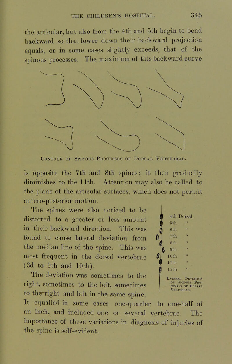 the articular, but also from the 4th and 5th begin to bend backward so that lower down their backward projection equals, or in some cases slightly exceeds, that of the spinous processes. The maximum of this backward curve Contour of Spinous Processes of Dorsal Vertebrae. is opposite the 7th and 8th spines; it then gradually diminishes to the 11th. Attention may also be called to the plane of the articular surfaces, which does not permit antero-posterior motion. The spines were also noticed to be distorted to a greater or less amount in their backward direction. This was found to cause lateral deviation from the median line of the spine. This was most frequent in the dorsal vertebrae (3d to 9th and 10th). The deviation was sometimes to the right, sometimes to the left, sometimes to therright and left in the same spine. It equalled in some cases one-quarter to one-half of an inch, and included one or several vertebrae. The importance of these variations in diagnosis of injuries of the spine is self-evident. Lateral Deviation OP Spinous Pro- cesses OP Dorsal Vertebrae.