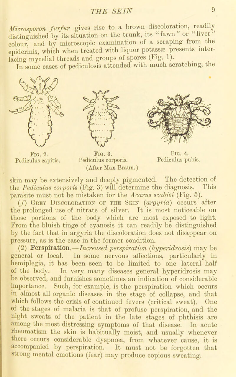 Microsporon furfur gives rise to a brown discoloration, readily distinguished by its situation on the trunk, its “ fawn or “ liver colour, and by microscopic examination of a scraping from the epidermis, which when treated with liquor potassse presents inter- lacing mycelial threads and groups of spores (big. 1 )• In some cases of pediculosis attended with much scratching, the (After Max Braun.) Fig. 4. Pediculus pubis. skin may be extensively and deeply pigmented. The detection of the Pediculus corporis (Fig. 3) will determine the diagnosis. This parasite must not be mistaken for the Acarus scabiei (Fig. 5). (/) Grey Discoloration of the Skin (argyria) occurs after the prolonged use of nitrate of silver. It is most noticeable on those portions of the body which are most exposed to light. From the bluish tinge of cyanosis it can readily be distinguished by the fact that in argyria the discoloration does not disappear on pressure, as is the case in the former condition. (2) Perspiration.—Increased perspiration (liyperidrosis) may be general or local. In some nervous affections, particularly in hemiplegia, it has been seen to be limited to one lateral half of the body. In very many diseases general liyperidrosis may be observed, and furnishes sometimes an indication of considerable importance. Such, for example, is the perspiration which occurs in almost all organic diseases in the stage of collapse, and that which follows the crisis of continued fevers (critical sweat). One of the stages of malaria is that of profuse perspiration, and the night sweats of the patient in the late stages of phthisis are among the most distressing symptoms of that disease. In acute rheumatism the skin is habitually moist, and usually whenever there occurs considerable dyspnoea, from whatever cause, it is accompanied by perspiration. It must not be forgotten that strong mental emotions (fear) may produce copious sweating.