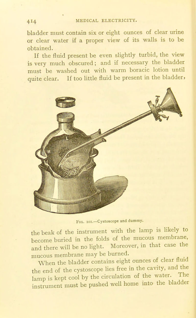 bladder must contain six or eight ounces of clear urine or clear water if a proper view of its walls is to be obtained. If the fluid present be even slightly turbid, the view is very much obscured; and if necessary the bladder must be washed out with warm boracic lotion until quite clear. If too little fluid be present in the bladder, Fig. ioi.—Cystoscope and dummy. the beak of the instrument with the lamp is likely to become buried in the folds of the mucous membrane, and there will be no Hght. Moreover, in that case the mucous membrane may be burned. When the bladder contains eight ounces of clear fluid the end of the cystoscope Hes free in the ca^dty, and the lamp is kept cool by the circulation of the water. The instrument must be pushed well home into the bladder
