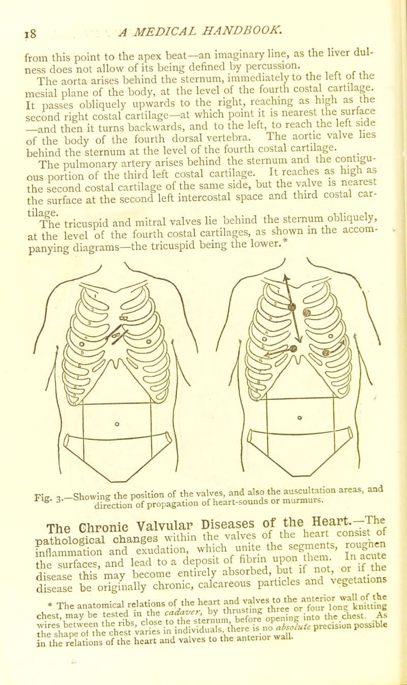 from this point to the apex beat—an imaginary hne, as the hver dul- ness does not allow of its being defined by percussion. The aorta arises behind the sternum, immediately to the left ot the mesial plane of the body, at the level of the fourth costal cartilage. It passes obliquely upwards to the right, reaching as high as the second right costal cartilage-at which point it is nearest the surface —and then it turns backwards, and to the left, to reach the left side of the body of the fourth dorsal vertebra. The aortic valve hes behind the sternum at the level of the fourth costal cartilage. The pulmonary artery arises behind the sternum and the contigu- ous portion of the third left costal cartilage. It reaches as high as the second costal cartilage of the same side, but the valve is nearest the surface at the second left intercostal space and third costal car- ^'^The tricuspid and mitral valves lie behind the sternum obliquely, at the level of the fourth costal cartilages, as shown m the accom- panying diagrams—the tricuspid bemg the lower. Fig. 3- -Showing the position of the valves, and also the auscultation areas, and drlction of propagation of heart-sounds or murmur.. The Ghponie Valvular Diseases of the Heart.-The T^atholoS changes within the valves of the heart consist of fnCmS and exudation, which unite the segments, rougnen the surfaces, and lead to a deposit of fibrin P0 hem In acu^e disease this may become entirely absorbed, but if not, or  tM disease be originally chronic, calcareous particles and vegetations * The anatomical relations of the heart ^^^^^^J^fl^ chest, may be tested in the f f ^'^V.rmmrSe opening into the chest. As in the relations of the heart and valves to the anterior wall.