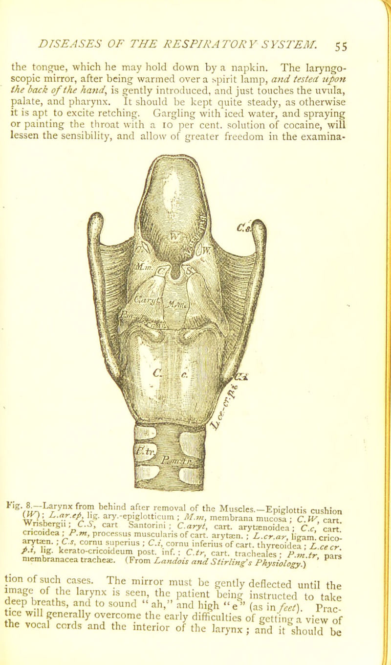 the tongue, which he may hold down by a napkin. The laryngo- scopic mirror, after being warmed over a spirit lamp, and tested upon the back of the hand, is gently introduced, and just touches the uvula, palate, and pharynx. It should be kept quite steady, as otherwise it is apt to excite retching. Gargling with iced water, and spraying or painting the throat with a 10 per cent, solution of cocaine, will lessen the sensibility, and allow of greater freedom in the examina- ^V^:^ IT ^^''^ ^-V '^^ Muscles—Epiglottis cushion («0. Z..«r.fA I'g. ary.-epiglotticum ; M.m, membrana mucosa ; C.W cart Wnsbergu; C.^-, cart Santorini ; C.aryt, cart. aryta:noidea ; C c cart cricoidea; /'.»j,proces<.usmuscularlsofcart. arytajn. ; L.cr.ar lie-am'cricol arytaen. - C.s, cornu superius ; C.i, cornu inferius of cart, thyreoidea ■ L ce cr p.t, hg. kerato-cricoideum post, inf.: C./r, cart, traclieales • P „: tr nar^ membranacea trachea:. (From Landois and Stirling's Physiology.) ' tion Of .such cases. The mirror must be gently deflected until the image of the larynx is seen, the patient being instructed to take deep breaths, and to sound  ah, and high  e  (as in feet). Prac ice W.11 generally overcome the early difficulties of gelling a view of the vocal cords and the interior of the larynx ; and it'shoulcrbe