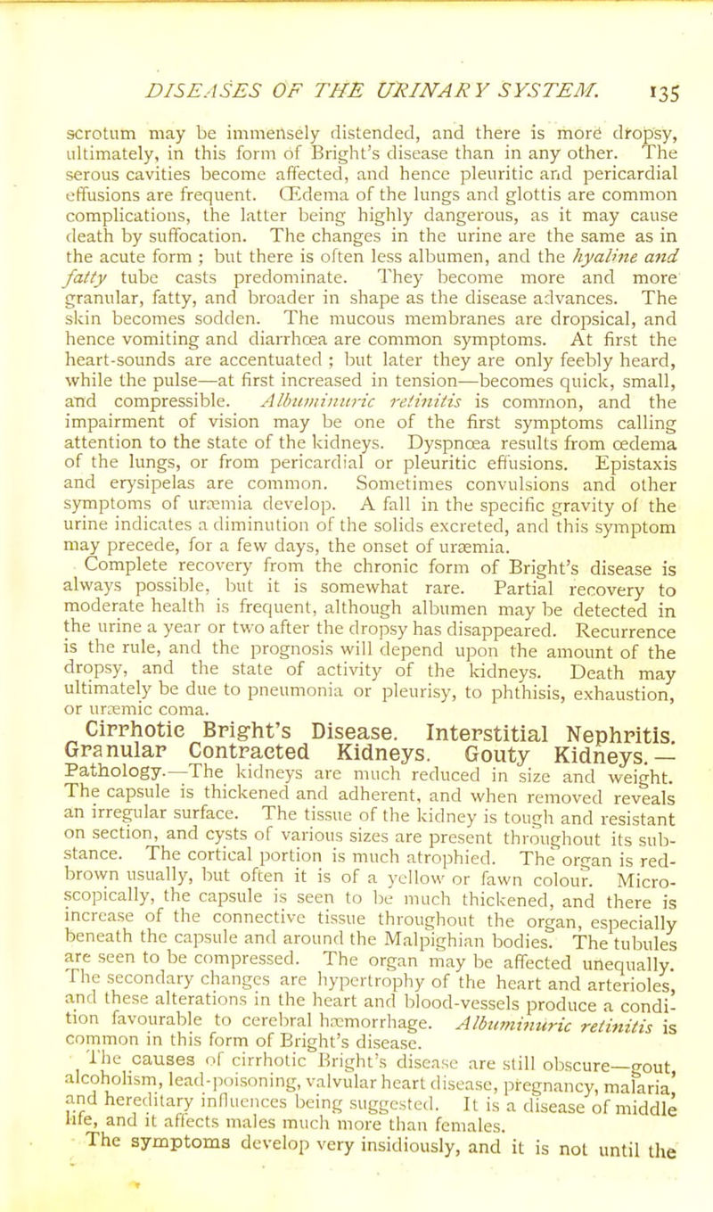 scrotum may be immensely distended, and there is more dropsy, ultimately, in this form of Bright's disease than in any other. The serous cavities become affected, and hence pleuritic and pericardial effusions are frequent. CEdema of the lungs and glottis are common complications, the latter being highly dangerous, as it may cause death by suffocation. The changes in the urine are the same as in the acute form ; but there is often less albumen, and the hyaline and fatty tube casts predominate. They become more and more granular, fatty, and broader in shape as the disease advances. The skin becomes sodden. The mucous membranes are dropsical, and hence vomiting and diarrhoea are common symptoms. At first the heart-sounds are accentuated ; but later they are only feebly heard, while the pulse—at first increased in tension—becomes quick, small, aTid compressible. Alhiimi)itiric retinitis is common, and the impairment of vision may be one of the first symptoms calling attention to the state of the kidneys. Dyspnoea results from oedema of the lungs, or from pericardial or pleuritic effusions. Epistaxis and erysipelas are common. Sometimes convulsions and other symptoms of ursmia develop. A fall in the specific gravity of the urine indicates a diminution of the solids excreted, and this symptom may precede, for a few days, the onset of uraemia. Complete recovery from the chronic form of Bright's disease is always possible, but it is somewhat rare. Partial recovery to moderate health is frequent, although albumen may be detected in the urine a year or two after the dropsy has disappeared. Recurrence is the rule, and the prognosis will depend upon the amount of the dropsy, and the state of activity of the kidneys. Death may ultimately be due to pneumonia or pleurisy, to phthisis, exhaustion, or urremic coma. Cipphotie Bpight's Disease. Intepstitial Nephpitis. Gpanulap Contpacted Kidneys. Gouty Kidneys.— Pathology.—The kidneys are much reduced in size and weight. The capsule is thickened and adherent, and when removed reveals an irregular surface. The tissue of the kidney is tougli and resistant on section, and cysts of various sizes are present throughout its sub- stance. The cortical portion is much atrophied. The organ is red- brown usually, but often it is of a yellow or fawn colour. Micro- scopically, the capsule is seen to lie much thickened, and there is mcrcase of the connective tissue throughout the organ, especially beneath the capsule and around the Malpighian bodies. The tubules are seen to be compressed. The organ may be affected unequally. The secondary changes are hypertrophy of the heart and arterioles and these alterations in the heart and blood-vessels produce a condi- tion favourable to cerebral hemorrhage. Albiimitmric retinitis is common in this form of Bright's disease. The causes of cirrhotic Bright's disease are still obscure gout alcohohsm, lead-poisoning, valvular heart disease, pregnancy, malaria' and hereditary innuences being suggested. It is a disease of middle lite, and it affects males much more than females. The symptoms develop very insidiously, and it is not until the