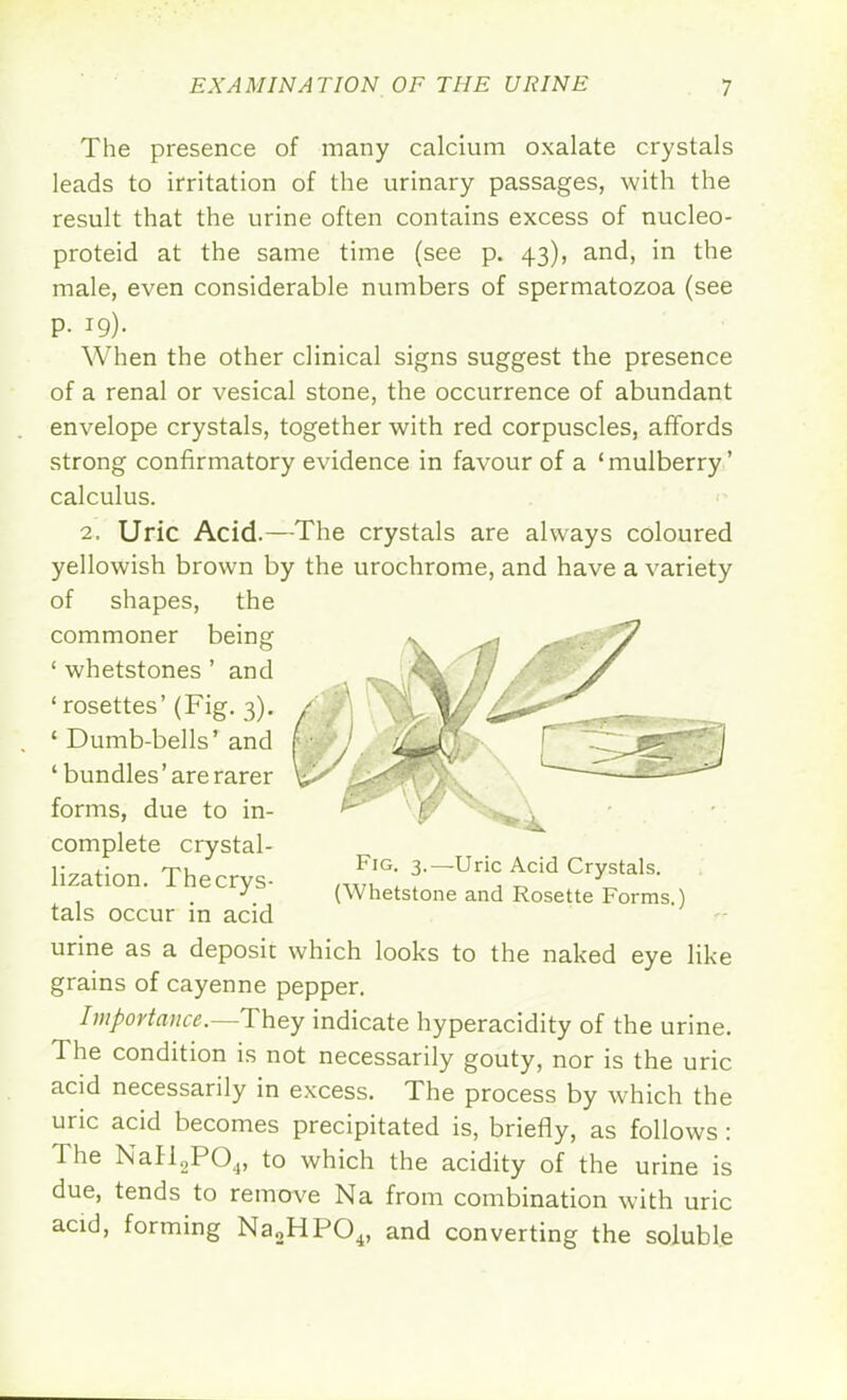 The presence of many calcium oxalate crystals leads to irritation of the urinary passages, with the result that the urine often contains excess of nucleo- proteid at the same time (see p. 43), and, in the male, even considerable numbers of spermatozoa (see p. 19). When the other clinical signs suggest the presence of a renal or vesical stone, the occurrence of abundant envelope crystals, together with red corpuscles, affords strong confirmatory evidence in favour of a 'mulberry' calculus. 2. Uric Acid.—The crystals are always coloured yellowish brown by the urochrome, and have a variety of shapes, the commoner being ' whetstones ' and ' rosettes' (Fig. 3). /'. ' Dumb-bells' and r; v ' bundles 'are rarer forms, due to in- '^^^vl complete crystal- lization Thecrvs- Fig. 3. Uric Acid Crystals. ^ (Whetstone and Rosette Forms.) tals occur in acid urine as a deposit which looks to the naked eye like grains of cayenne pepper. Importance.—They indicate hyperacidity of the urine. The condition is not necessarily gouty, nor is the uric acid necessarily in excess. The process by which the uric acid becomes precipitated is, briefly, as follows : The NaIl2P04, to which the acidity of the urine is due, tends to remove Na from combination with uric acid, forming Na2HP04, and converting the soluble