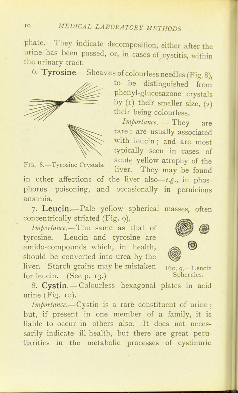 e 1!) Fig. 8.—Tyrosine Crystals. phate. They indicate decomposition, either after th urine has been passed, or, in cases of cystitis, withi the urinary tract. 6. Tyrosine. — Sheaves of colourless needles (Fig. 8), to be distinguished from phenyl-glucosazone crystals by (i) their smaller size, (2) their being colourless. Importance. — They are rare ; are usually associated with leucin ; and are most typically seen in cases of acute yellow atrophy of the liver. They may be found in other affections of the liver also—e.g., in phos- phorus poisoning, and occasionally in pernicious anaemia. 7. Leucin.—Pale yellow spherical masses, often concentrically striated (Fig. 9). Importance.—The same as that of tyrosine. Leucin and tyrosine are amido-compounds which, in health, should be converted into urea by the liver. Starch grains may be mistaken for leucin. (See p. 13.) 8. Cystin.— Colourless hexagonal plates in acid urine (Fig. 10). Importance.—Cystin is a rare constituent of urine ; but, if present in one member of a family, it is liable to occur in others also. It does not neces- sarily indicate ill-health, but there are great pecu- liarities in the metabolic processes of cystinuric Fig. 9.—Leucin Spherules.