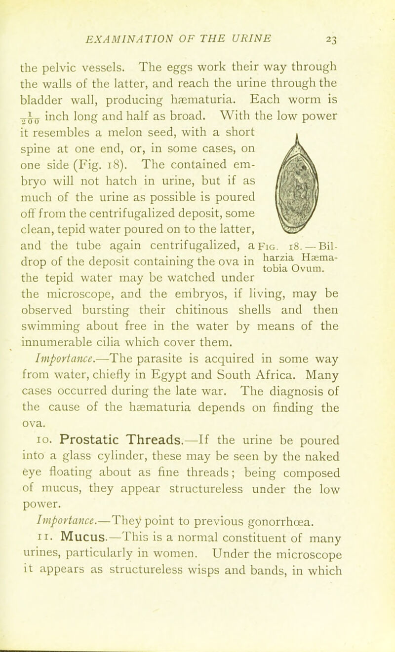 the pelvic vessels. The eggs work their way through the walls of the latter, and reach the urine through the bladder wall, producing hematuria. Each worm is inch long and half as broad. With the low power it resembles a melon seed, with a short spine at one end, or, in some cases, on one side (Fig. 18). The contained em- bryo will not hatch in urine, but if as much of the urine as possible is poured off from the centrifugalized deposit, some clean, tepid water poured on to the latter, and the tube again centrifugalized, a Fig. 18. —Bil- drop of the deposit containing the ova in ^^o^m1*1 the tepid water may be watched under the microscope, and the embryos, if living, may be observed bursting their chitinous shells and then swimming about free in the water by means of the innumerable cilia which cover them. Importance.—The parasite is acquired in some way from water, chiefly in Egypt and South Africa. Many cases occurred during the late war. The diagnosis of the cause of the hematuria depends on finding the ova. 10. Prostatic Threads.—If the urine be poured into a glass cylinder, these may be seen by the naked eye floating about as fine threads; being composed of mucus, they appear structureless under the low power. Importance.—They point to previous gonorrhoea. 11. Mucus.—This is a normal constituent of many urines, particularly in women. Under the microscope it appears as structureless wisps and bands, in which