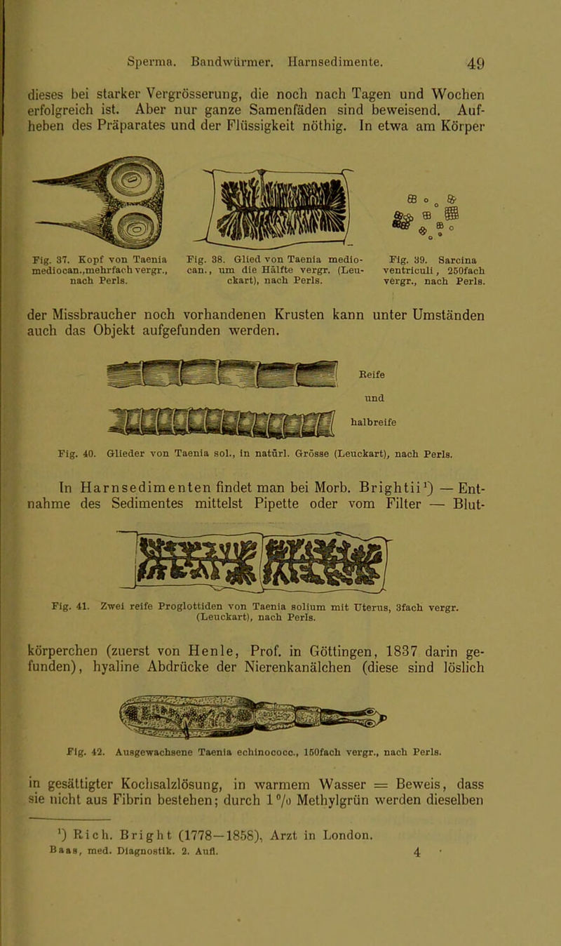 dieses bei starker Vergrösserung, die noch nach Tagen und Wochen erfolgreich ist. Aber nur ganze Samenfäden sind beweisend. Auf- heben des Präparates und der Flüssigkeit nöthig. In etwa am Körper Fig. 37. Kopf von Taenia Fig. 38. Glied von Taenia medio- Fig. 39. Sarcina mediocan.,mehrfach vergr., can., um die Hälfte vergr. (Leu- ventriculi, 250faeh nach Perls. ckart), nach Perls. vergr., nach Perls. der Missbraucher noch vorhandenen Krusten kann unter Umständen auch das Objekt aufgefunden werden. Eeife und halbreife Fig. 40. Glieder von Taenia sol., in natürl. Grösse (Leuckart), nach Perls. In Harnsedimenten findet man bei Morb. Brightii1)—Ent- nahme des Sedimentes mittelst Pipette oder vom Filter — Blut- Fig. 41. Zwei reife Proglottiden von Taenia solium mit Uterus, 3fach vergr. (Leuckart), nach Perls. körperchen (zuerst von Henle, Prof. in Göttingen, 1837 darin ge- funden), hyaline Abdrücke der Nierenkanälchen (diese sind löslich Fig. 42. Ausgewachsene Taenia echinococc, ISOfach vergr., nach Perls. in gesättigter Kochsalzlösung, in warmem Wasser = Beweis, dass sie nicht aus Fibrin bestehen; durch 1°/» Methylgrün werden dieselben ') Rieh. Bright (1778-1858), Arzt in London. Baas, med. Diagnostik. 2. Aufl. 4