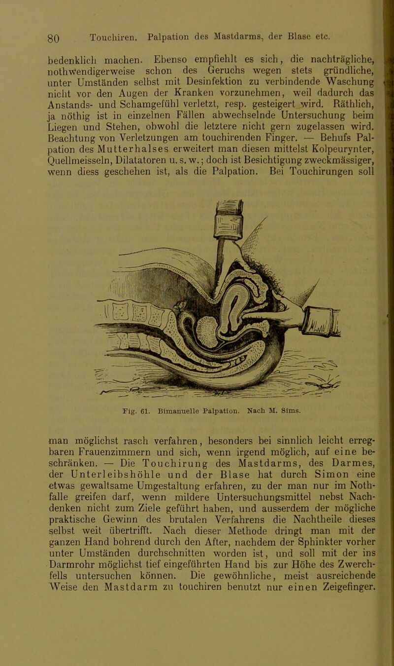 bedenklich machen. Ebenso empfiehlt es sich, die nachträgliche, nothwendigerweise schon des Geruchs wegen stets gründliche, unter Umständen selbst mit Desinfektion zu verbindende Waschung nicht vor den Augen der Kranken vorzunehmen, weil dadurch das Anstands- und Schamgefühl verletzt, resp. gesteigert wird. Räthlich, ja nöthig ist in einzelnen Fällen abwechselnde Untersuchung beim Liegen und Stehen, obwohl die letztere nicht gern zugelassen wird. Beachtung von Verletzungen am touchirenden Finger. — Behufs Pal- pation des Mutterhalses erweitert man diesen mittelst Kolpeurynter, Quellmeisseln, Dilatatoren u.s.w.; doch ist Besichtigung zweckmässiger, wenn diess geschehen ist, als die Palpation. Bei Touchirungen soll Fig. 61. Bimanuelle Palpation. Nach M. Sims. man möglichst rasch verfahren, besonders bei sinnlich leicht erreg- baren Frauenzimmern und sich, wenn irgend möglich, auf eine be- schränken. — Die Touchirung des Mastdarms, des Darmes, der Unterleibshöhle und der Blase hat durch Simon eine etwas gewaltsame Umgestaltung erfahren, zu der man nur im Noth- falle greifen darf, wenn mildere Untersuchungsmittel nebst Nach- denken nicht zum Ziele geführt haben, und ausserdem der mögliche praktische Gewinn des brutalen Verfahrens die Nachtheile dieses selbst weit übertrifft. Nach dieser Methode dringt man mit der ganzen Hand bohrend durch den After, nachdem der Sphinkter vorher unter Umständen durchschnitten worden ist, und soll mit der ins Darmrohr möglichst tief eingeführten Hand bis zur Höhe des Zwerch- fells untersuchen können. Die gewöhnliche, meist ausreichende Weise den Mastdarm zu touchiren benutzt nur einen Zeigefinger.