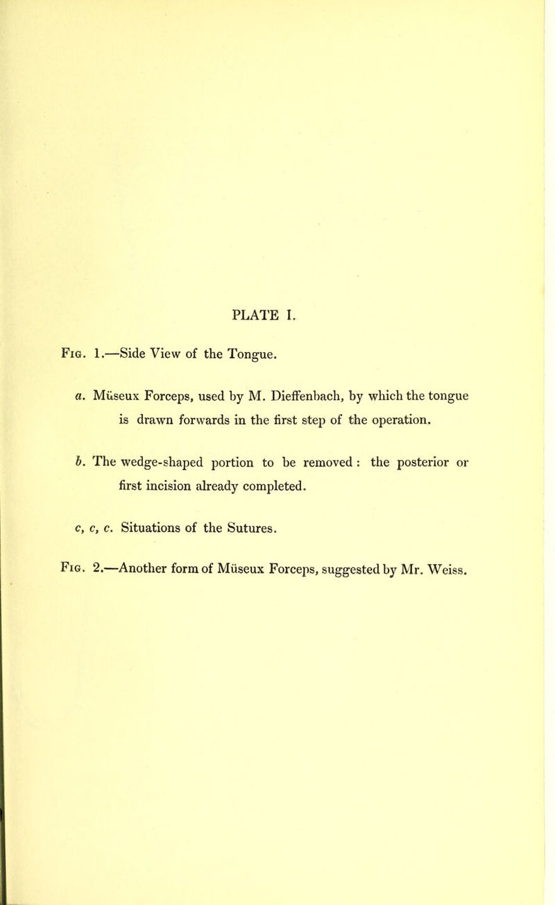 Fig. 1.—Side View of the Tongue. a. Miiseux Forceps, used by M. DiefFenbach, by which the tongue is drawn forwards in the first step of the operation. h. The wedge-shaped portion to be removed : the posterior or first incision already completed. c, c, c. Situations of the Sutures. Fig. 2.—Another form of Miiseux Forceps, suggested by Mr. Weiss.