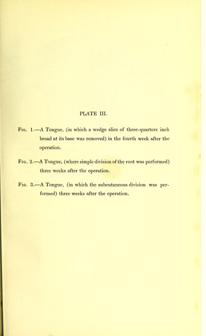 Fig. 1.-—A Tongue, (in which a wedge sHce of three-quarters inch broad at its base was removed) in the fourth week after the operation. Fig. 2.—A Tongue, (where simple division of the root was performed) three weeks after the operation. Fig. 3.—A Tongue, (in which the subcutaneous division was per- formed) three weeks after the operation.