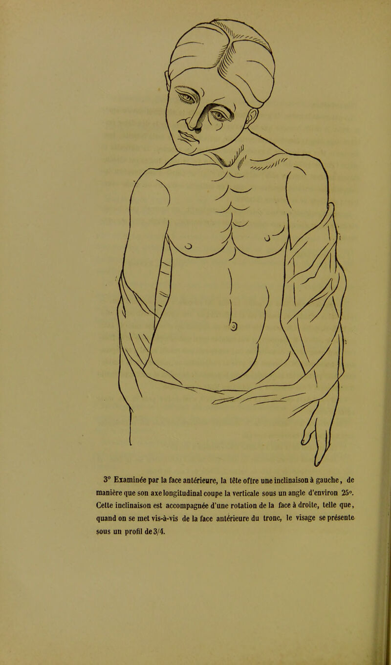 3° Examinée par la face antérieure, la tête offre une inclinaison à gauche, de manière que son axe longitudinal coupe la verticale sous un angle d’environ 25°. Celte inclinaison est accompagnée d’une rotation de la face à droite, telle que, quand on se met vis-à-vis de la face antérieure du tronc, le visage se présente sous un profil de 3/4.