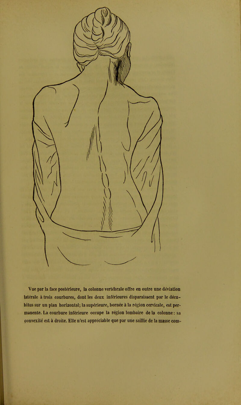 Vue par la face postérieure, la colonne vertébrale offre en outre une déviation latérale à trois courbures, dont les deux inférieures disparaissent par le décu- bitus sur un plan horizontal; la supérieure, bornée à la région cervicale, est per- manente. La courbure inférieure occupe la région lombaire de la colonne : sa ponvcxilé est à droite. Elle n’est appréciable que par une saillie de la masse corn-