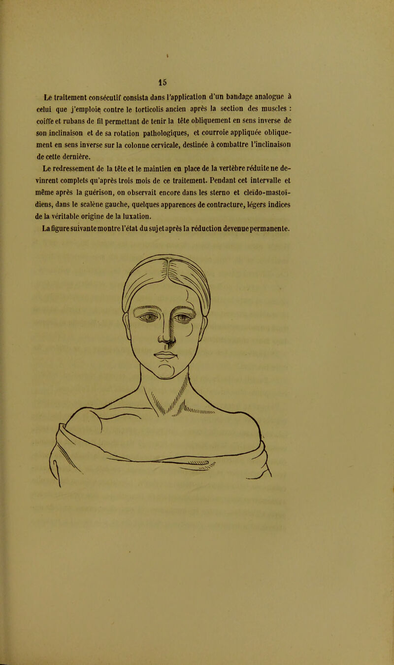 Le traitement consécutif consista dans l’application d’un bandage analogue à celui que j’emploiq contre le torticolis ancien après la section des muscles : coiffe et rubans de fil permettant de tenir la tête obliquement en sens inverse de son inclinaison et de sa rotation pathologiques, et courroie appliquée oblique- ment en sens inverse sur la colonne cervicale, destinée à combattre l’inclinaison de cette dernière. Le redressement de la tête et le maintien en place de la vertèbre réduite ne de- vinrent complets qu’après trois mois de ce traitement. Pendant cet intervalle et même après la guérison, on observait encore dans les sterno et cleïdo-mastoï- diens, dans le scalène gauche, quelques apparences de contracture, légers indices de la véritable origine de la luxation. La figure suivante montre l’état du suj et après la réduction devenue permanen le.