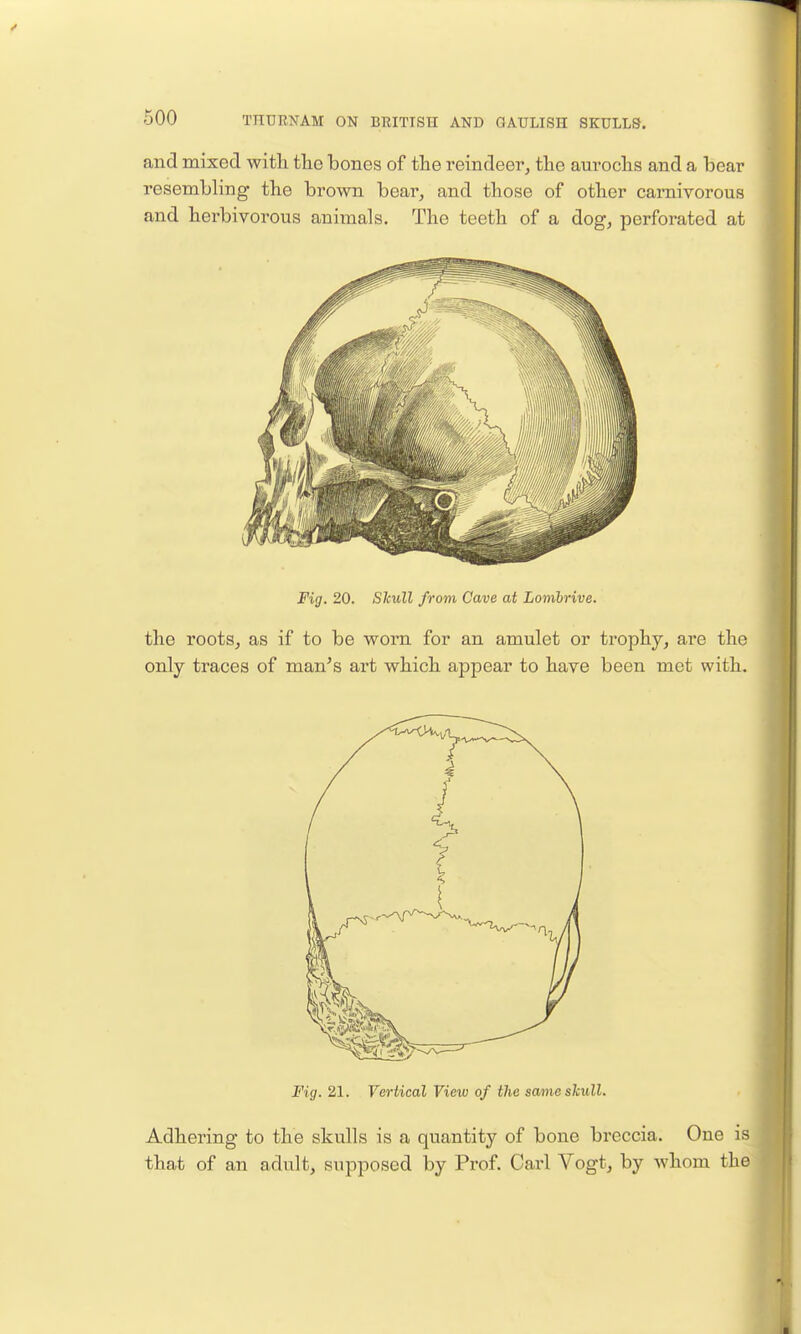 and mixed with the bones of the reindeer, the aurochs and a bear resembling the brown bear, and those of other carnivorous and herbivorous animals. The teeth of a dog, perforated at Fig. 20. Shull from Cave at Lonibrive. the roots, as if to be worn for an amulet or trophy, are the only traces of man^s art which appear to have been met with. Fig. 21. Vertical View of the scmie skull. Adhering to the skulls is a quantit}'- of bone breccia. One is that of an adult, supposed by Prof. Carl Vogt, by whom the