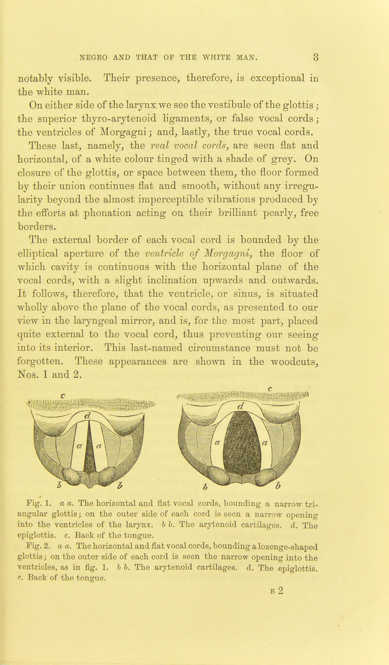 notably visible. Their presence, therefore, is exceptional in the white man. On either side of the larynx we see the vestibule of the glottis ; the superior thyro-arytenoid ligaments, or false vocal cords; the ventricles of Morgagni; and, lastly, the true vocal cords. These last, namely, the real vocal cords, are seen flat and horizontal, of a white colour tinged with a shade of grey. On closure of the glottis, or space between them, the floor formed by their union continues flat and smooth, without any irregu- larity beyond the almost imperceptible vibrations produced by the efforts at phonation acting on their brilliant pearly, free borders. The external border of each vocal cord is bounded by the elliptical aperture of the ventricle of Morgagni, the floor of which cavity is continuous with the horizontal plane of the vocal cords, with a slight inclination upwards and outwards. It follows, therefore, that the ventricle, or sinus, is situated wholly above the plane of the vocal cords, as presented to our view in the laryngeal mirror, and is, for the most part, placed quite external to the vocal cord, thus preventing our seeing into its interior. This last-named circumstance must not be forgotten. These appearances are shown in the woodcuts, Nos. 1 and 2. Fig. 1. a a. The horizontal and flat vocal cords, bounding a narrow tri- angular glottis; on the outer side of each cord is seen a narrow opening into the ventricles of the larynx, b b. The arytenoid cartilages, d. The epiglottis, c. Back of the tongue. Fig. 2. a a. The horizontal and flat vocal cords, bounding a lozenge-shaped glottis; on the outer side of each cord is seen the narrow opening into the ventricles, as in fig. 1. b b. The arytenoid cartilages, d. The epiglottis, c. Back of the tongue. b2