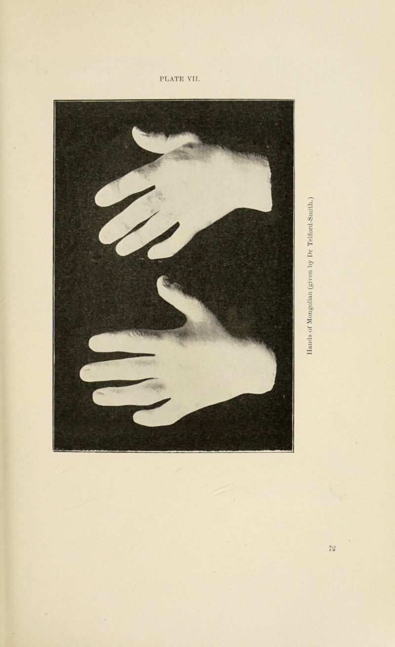 PLATE VIr 1'1 Hands of Mongolian (given by Dr Telford-Smith.)