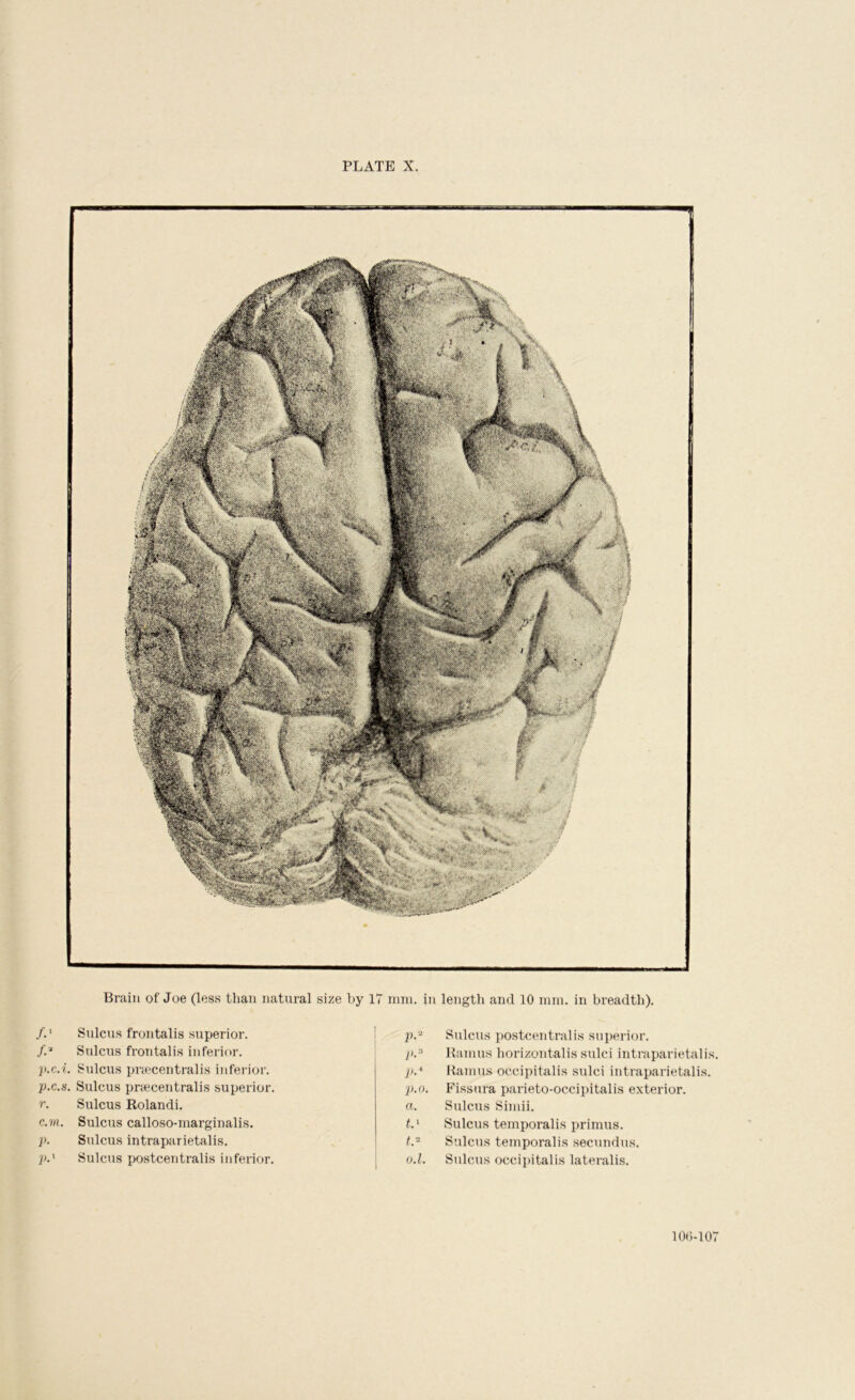 Brain of Joe (less than natural size by 17 /.' Sulcus frontalis superior. ! f:‘ Sulcus frontalis inferior. ji.c.i. Sulcus pnccentralis inferior. р. c.s. Sulcus praecentralis superior. r. Sulcus Rolandi. с. m. Sulcus calloso-marginalis. p. Sulcus intraparietalis. p.' Sulcus postcentralis inferior. nun. in length and 10 min. in breadth). p.'^ Sulcus postcentralis superior. Ramus horizontalis sulci intraparietalis. }i.-' Ramus occipitalis sulci intraparietalis. p.o. Fissura parieto-occipitalis exterior. a. Sulcus Simii. Sulcus temporalis primus. t. - Sulcus temporalis secundus. u. l. Sulcus occipitalis lateralis. 10()-10r