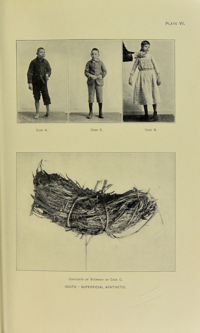 Case A. Case C. Case B. Contents of Stomach of Case C. IDIOTS —SUPERFICIAL APATHETIC.