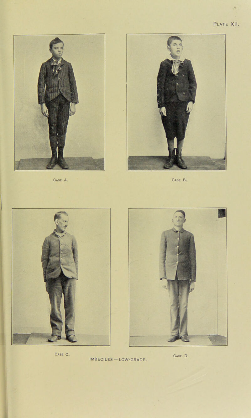 Case A. Case B. Case C. IMBECILES — LOW-GRADE. Case D.