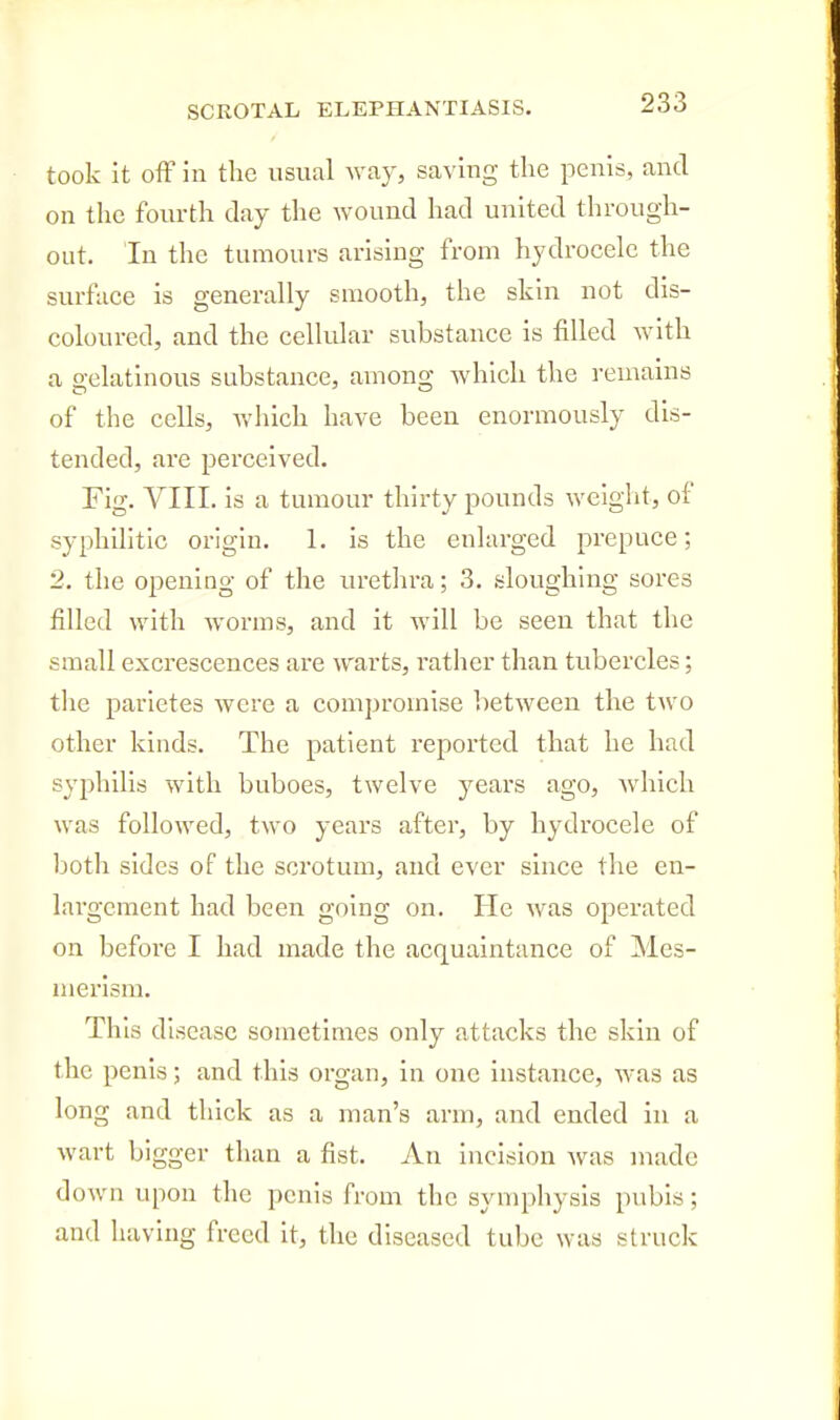 took it off In the usual way, saving the penis, and on the fourth day the wound had united through- out. In the tumours arising from hydrocele the surface is generally smooth, the skin not dis- coloured, and the cellular substance is filled with a gelatinous substance, among which the remains of the cells, which have been enormously dis- tended, are perceived. Fig. VIII. is a tumour thirty pounds weight, of syphilitic origin. 1. is the enlarged prepuce; 2. the opening of the uretlu-a; 3. sloughing sores filled with worms, and it will be seen that the small excrescences are warts, rather than tubercles; the parietes were a compromise between the two other kinds. The patient reported that he had syphilis with buboes, twelve years ago, which was followed, two years after, by hydrocele of both sides of the scrotum, and ever since the en- largement had been going on. He was operated on before I had made the acquaintance of Mes- merism. This disease sometimes only attacks the skin of the penis; and this organ, in one instance, was as long and thick as a man's arm, and ended in a wart bigger than a fist. An incision was made down upon the penis from the symphysis pubis; and liaving freed it, the diseased tube was struck