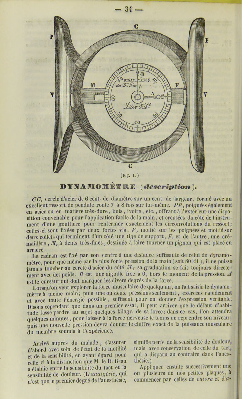 D¥KA!TI09IÈTRE ( tlescviplion ). CC, cercle d’acier de 6 cent, de diamètre sur un cent, de largeur, formé avec un excellent ressort de pendule roulé 7 à 8 fois sur lui-même. PP, poignées également en acier ou en matière très-dure, buis, ivoire, etc., offrant à l’extérieur une dispo- sition convenable pour l’application facile de la main, et creusées du côté de l’instru- ment d’une gouttière pour renfermer exactement les circonvolutions du ressort; celles-ci sont fixées par deux fortes vis, V> moitié sur les poignées et moitié sur deux collets qui terminent d’un côté une tige de support, F, et de l’autre, une cré- maillère , M, à dents très-fines , destinée à faire tourner un pignon qui est placé eu arrière. Le cadran est fixé par son centre à une distance suffisante de celui du dynamo- mètre, pour que même par la plus forte pression de la main (soit 80 kil.), il ne puisse jamais toucher au cercle d’acier du côté 1\1 ; sa graduation se fait toujours directe- ment avec des poids. B est une aiguille fixe à 0, hors le moment de la pression. A est le curseur qui doit marquer les divers degrés de la force. Lorsqu’on veut explorer la force musculaire de quelqu’un, on fait saisir le dynamo- mètre à pleine main; puis une ou deux pressions seulement, exercées rapidement et avec toute l’énergie possible, suffisent pour en donner l’expression véritable. Disons cependant que dans un premier essai, il peut arriver que le défaut d’habi- tude fasse perdre au sujet quelques kilogr. de sa force; dans ce cas, l’on attendra quelques minutes, pour laisser à la force nerveuse le temps de reprendre son niveau ; puis une nouvelle pression devra donner le chiffre exact de la puissance musculaire du membre soumis à l’expérience. Arrivé auprès du malade , s’assurer d’abord avec soin de l’état de la motilité et de la sensibilité, en ayant égard pour celle-ci à la distinction que M. le Dr Beau a établie entre la sensibilité du tact et la sensibilité de douleur. (L'analgésie, qui n’est que le premier degré de l’anesthésie, signifie perle delà sensibilité de douleur, mais avec conservation de celle du tact, qui a disparu au contraire dans l’anes- thésie.) Appliquer ensuite successivement une ou plusieurs de nos petites plaques, à commencer par celles de cuivre et d’rt-