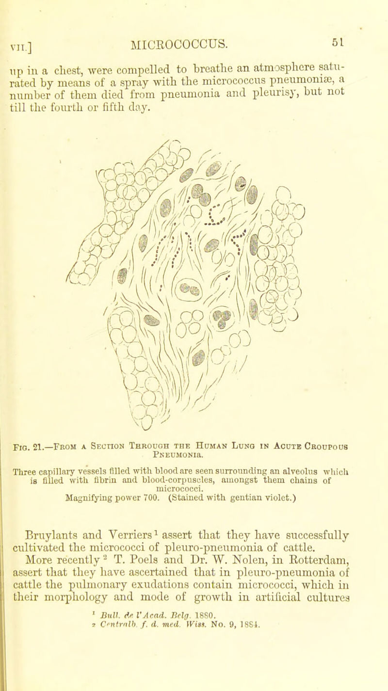 lip in a chest, were compelled to breathe an atmosphere satu- rated by means of a spray with the micrococcns pneumoniae, a number of them died from pneumonia and pleurisy, but not till the fourth or fifth day. Fio. 21.—From a Sf.ction Tekouoh the Human Lhnq in Acute Croupous PNEUMONia. Tliree capi!lai7 vessels filled with blood are seen surrounding an alveolus wliich is filled with fibrin and blood-corpuscles, amongst them chains of micrococci. Magnifying power 700. (Stained with gentian violet.) Bniylants and Terriers ^ assert that they have successfully cultivated the micrococci of pleuro-pneumonia of cattle. More recently - T. Poels and Dr. W. Nolen, in Rotterdam, assert that they have ascertained that in pleuro-pneumonia of cattle the pulmonary exudations contain micrococci, which in their morphology and mode of growth in artificial cultures ' Bttll. fA I'Acad. Bclff. 18S0. I C'ntrnU). f. d. med. Wiss. No. 9, ISSJ.