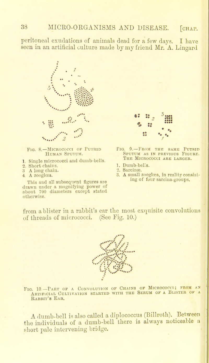 peritoneal exudations of animals dead for a few daj's. I liave seen in an artificial culture made by my friend Mr. A. Lingard •: ••••• — Fia. 8.—Micrococci of Putiiid Hdman Sputum. 1. Sinple micrococci and dumb-bells. 2. Short chains. 3 A long chain. 4. A zoogloea. Tliis and all subsequent figures are drawn under a ran.gnifying power of about 700 diameters except stated otlierwise. Fig. 9.—From the same Putrid Sputum as in previous Figure. The Micrococci are larger. 1. Dunib-bei:s. 2. SarciniE. 3. A small zooglcea, in reality consist- ing of four sarciua-groups. from a blister in a rabbit's ear the most exquisite convolutions of threads of micrococci. (See Fig. 10.) • A..-! ..V J • -• :'•/ • • Fig. 10—Part of a Convolution of Chains op Micrococci; from an Artificial Cultivation started with the Serum of a Blister ok a Rabbit's Ear. A dumb-bell is also called a diplococcus (Billroth). Between the individuals of a dumb-bell there is always noticeable a Bhort pale intervening bridge.