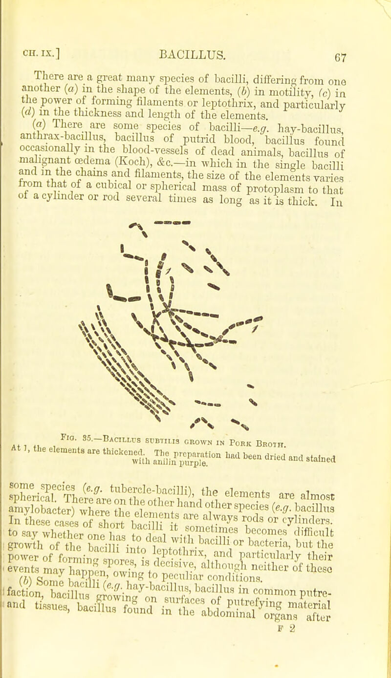 There are a great many species of bacilli, differing from ouo another (a) m the shape of the elements, (b) in motility, (c) in the power of forming filaments or leptothrix, and particularly [d) m the tluckness and length of the elements. («) There are some species of bacilli—e.^^. hay-bacillus, anthi;ax-bacillus, bacillus of putrid blood, bacillus found occasionally m the blood-vessels of dead animals, bacillus of malignant redema (Koch), &c.-in which in the single bacilli and m the chams and filaments, the size of the elements varies from that of a cubical or spherical mass of protoplasm to that of a cylinder or rod several times as long as it is thick. In \ » « ^ — ^ Fio. S5.-BACILWS srBTHia grown in Pork Broth. iower of >„;„,,■„ „' ° Y° '\ P»rti<:lly their events maFhSn ^o ! m I?'*;'' ''°!'.' °t