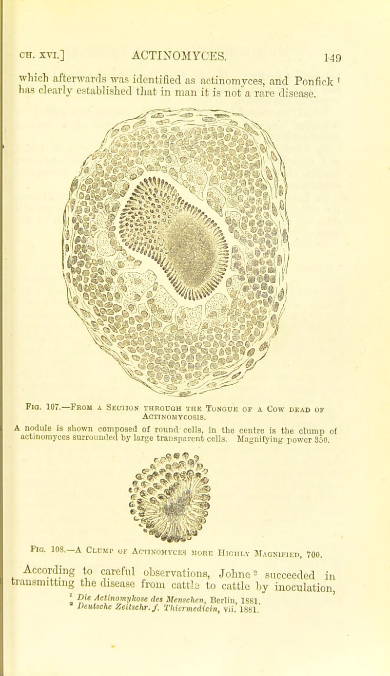 which afterwards was identified as actinomyces, and Ponfick ' has clearly established that in man it is not a rare disease. I.—A Clump of Activomyce.s more Hiciily JTagnified, 700. According to careful observations, Johne = succeeded in [■ausmittnig the disease from cattle to cattle by inoculation, ' Die AcUnomijkose cles Menschnn, Berlin, 1S81 Deutsche Zeitschr.f. Thicrmedicin, vii. 1881.'