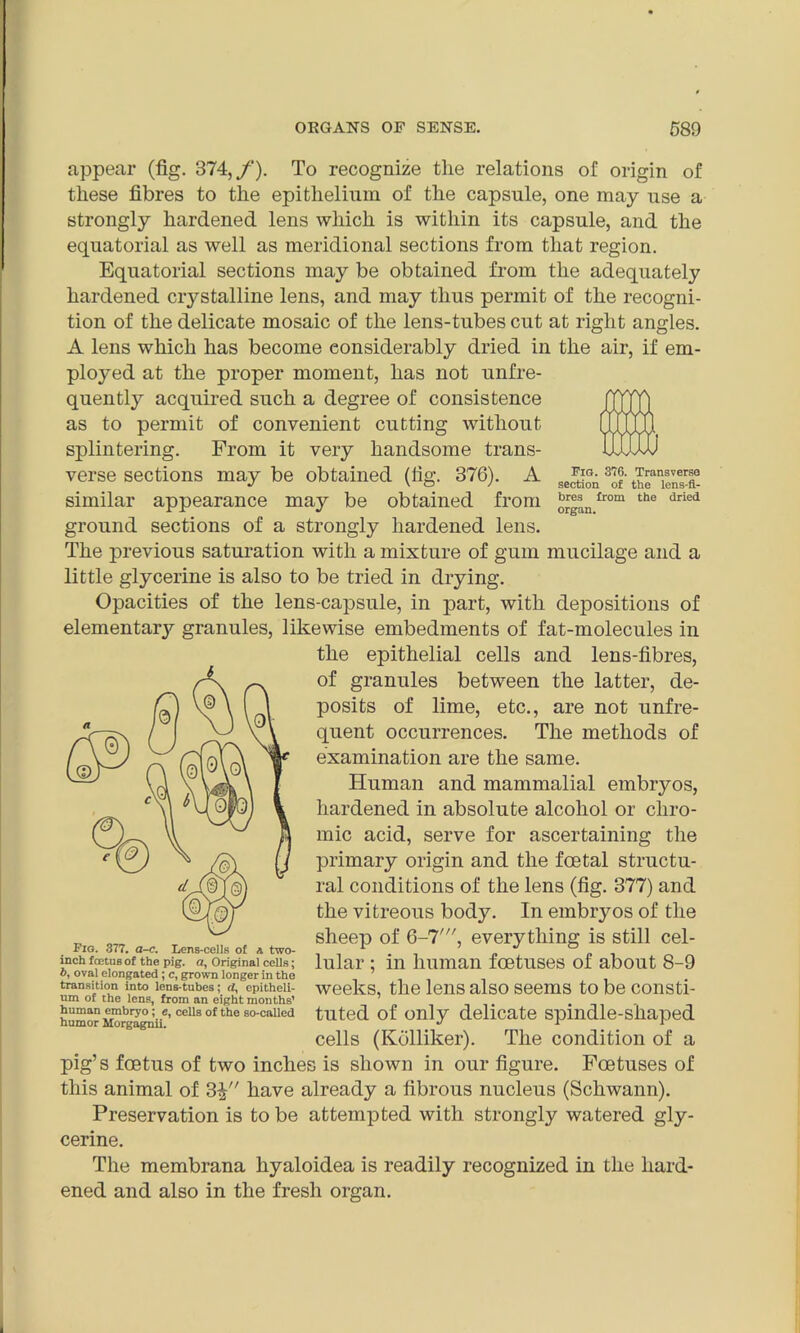 appear (fig. 374, /'). To recognize the relations of origin of these fibres to the epithelium of the capsule, one may use a strongly hardened lens which is within its capsule, and the equatorial as well as meridional sections from that region. Equatorial sections may be obtained from the adequately hardened crystalline lens, and may thus permit of the recogni- tion of the delicate mosaic of the lens-tubes cut at right angles. A lens which has become considerably dried in the air, if em- ployed at the proper moment, has not unfre- quently acquired such a degree of consistence as to permit of convenient cutting without splintering. From it very handsome trans- verse sections may be obtained (fig. 376). A similar appearance may be obtained from 110111 the dried ground sections of a strongly hardened lens. The previous saturation with a mixture of gum mucilage and a little glycerine is also to be tried in drying. Opacities of the lens-capsule, in part, with depositions of elementary granules, likewise embedments of fat-molecules in the epithelial cells and lens-fibres, of granules between the latter, de- posits of lime, etc., are not unfre- quent occurrences. The methods of examination are the same. Human and mammalial embryos, hardened in absolute alcohol or chro- mic acid, serve for ascertaining the primary origin and the foetal structu- ral conditions of the lens (fig. 377) and the vitreous body. In embryos of the sheep of 6-7', everything is still cel- lular ; in human foetuses of about 8-9 weeks, the lens also seems to be consti- tuted of only delicate spindle-shaped cells (Kolliker). The condition of a pig’s foetus of two inches is shown in our figure. Foetuses of this animal of 3£ have already a fibrous nucleus (Schwann). Preservation is to be attempted with strongly watered gly- cerine. The membrana hyaloidea is readily recognized in the hard- ened and also in the fresh organ. Fig. 377. a-c. Lens-cells of a two- inch foetus of the pig. a, Original cells; b, oval elongated ; c, grown longer in the transition into lens-tubes; d, epitheli- um of the lens, from an eight months’ human embryo; e, cells of the so-called humor Morgagnii.