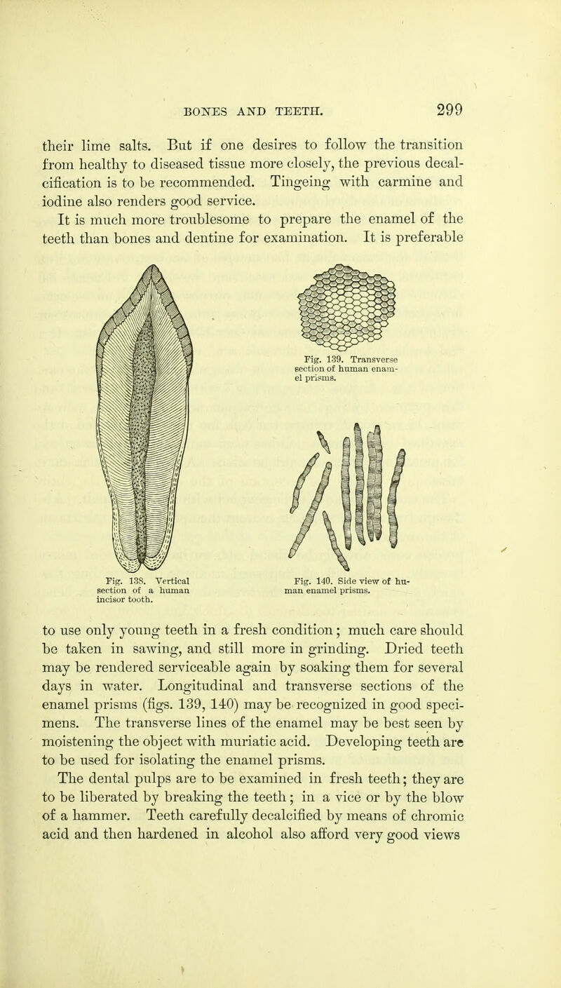 their lime salts. But if one desires to follow the transition from healthy to diseased tissue more closely, the previous decal- cification is to be recommended. Tingeing with carmine and iodine also renders good service. It is much more troublesome to prepare the enamel of the teeth than bones and dentine for examination. It is preferable Fig. 13S. Vertical Fig. 140. Side view of hu- Bectiou of a human man enamel prisms, incisor tooth. to use only young teeth in a fresh condition; much care should be taken in sawing, and still more in grinding. Dried teeth may be rendered serviceable again by soaking them for several days in water. Longitudinal and transverse sections of the enamel prisms (figs. 139, 140) may be recognized in good speci- mens. The transverse lines of the enamel may be best seen by moistening the object with muriatic acid. Developing teeth are to be used for isolating the enamel prisms. The dental pulps are to be examined in fresh teeth; they are to be liberated by breaking the teeth ; in a vice or by the blow of a hammer. Teeth carefully decalcified by means of chromic acid and then hardened in alcohol also afford very good views