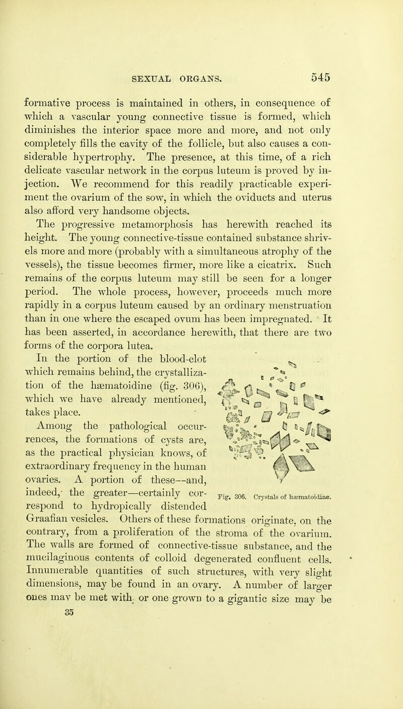 formative process is maintained in others, in consequence of which a vascnlar young connective tissue is formed, which diminishes the interior space more and more, and not only completely fills the cavity of the follicle, but also causes a con- siderable hypertrophy. The presence, at this time, of a rich delicate vascular network in the corpus liiteum is proved by in- jection. We recommend for this readily practicable experi- ment the ovarium of the sow, in which the oviducts and uterus also afford very handsome objects. The progressive metamorphosis has herewith reached its height. The young connective-tissue contained substance shriv- els more and more (probably with a simultaneous atrophy of the vessels), the tissue becomes firmer, more like a cicatrix. Such remains of the corpus luteum may still be seen for a longer period. The whole process, however, proceeds much more rapidly in a corpus luteum caused by an ordinary menstruation than in one where the escaped ovum has been impregnated. It has been asserted, in accordance herewith, that there are two forms of the corpora lutea. In the portion of the blood-clot which remains behind, the crystalliza- tion of the hsematoidine (fig. 306), which we have already mentioned, takes place. Among the pathological occur- rences, the formations of cysts are, as the practical physician knows, of extraordinary frequency in the human ovaries. A portion of these—and, indeed,- the greater—certainly cor- ^,5^,306. crystals of h«.matokUne. respond to hydropically distended Graafian vesicles. Others of these formations originate, on the contrary, from a proliferation of the stroma of the ovarium. The walls are formed of connective-tissue substance, and the mucilaginous contents of colloid degenerated confluent cells. Innumerable quantities of such structures, with very slight dimensions, may be found in an ovary. A number of larger ones may be met with, or one grown to a gigantic size may be 35