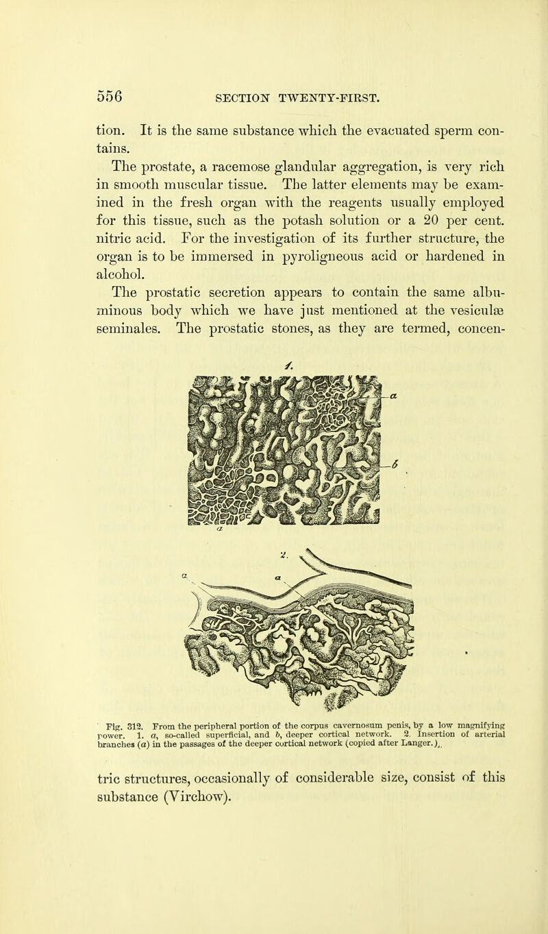 tion. It is the same substance wliicli the evacuated sperm con- tains. The prostate, a racemose glandular aggregation, is very rich in smooth muscular tissue. The latter elements may be exam- ined in the fresh organ with the reagents usually employed for this tissue, such as the potash solution or a 20 per cent, nitric acid. For the investigation of its farther structure, the organ is to be immersed in pyroligneous acid or hardened in alcohol. The prostatic secretion appears to contain the same albu- minous body which we have just mentioned at the vesiculse seminales. The prostatic stones, as they are termed, concen- ■ Fig. 312. From the peripheral portion of the corpus cavernosum penis, by a low magnifj-inpr rower. 1. a, so-called supei-flcial, and 6, deeper cortical network. 2. Insertion of arterial branches (a) in the passages of the deeper cortical network (copied after Langer.}^ trie structures, occasionally of considerable size, consist of this substance (Virchow).