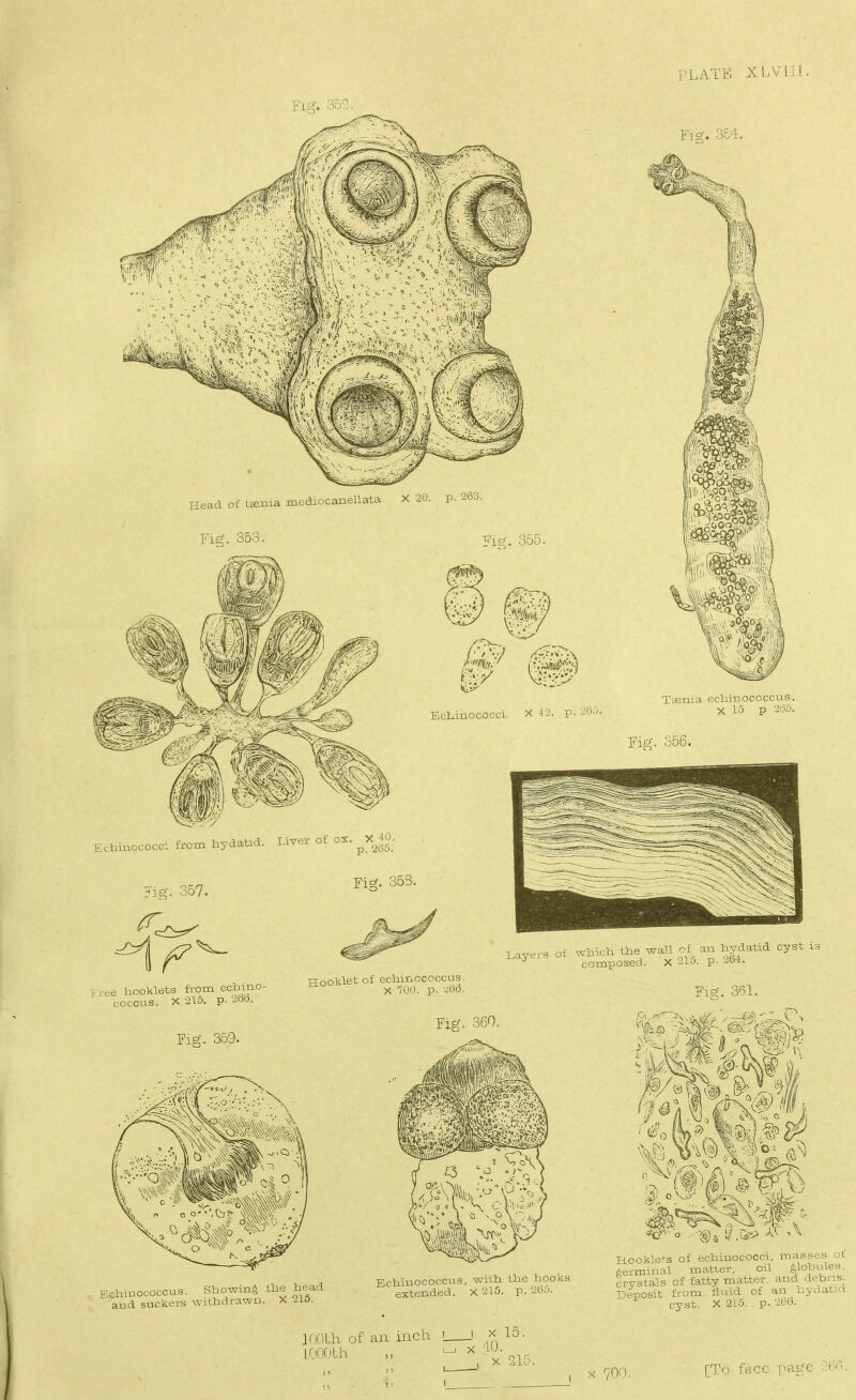 I 'LATE XLViJi. Fi&. 354, Head of tgenia mediocanellata. X 20. p. 263. Fig. 353. Fie. 355. Echinococci. X 42. p. 2bi- Taenia ecbinococcus. X 15 p 2iD6. Fig. 856. Ecbinococci from bydabxd. Liver of ox. Fig. 357. Fig. 353. V ree Iicoklets from ecbino- COCCU8. X215. p. 2fc.b. TToolilet of ecliinococcus. X 700. p. -^06. L.ayers of wMch toe wall of an hydatid cyst is composed. X 210. p. M'±. 361. Fig. 359. Fig. 360. Eclimococcus. Showing the head and suckers withdrawn. X 215. Echinococcus, with the hooks extended. X 215. p. 200. Hookle^s of echinococci, masses of germinal matter, oil globules, crystals of fatty matter, and d^^bns Deposit from fluid of an h>.iaL:.t cyst. X 215, p. 20D. ]ri()Ui of an inch i ^ >< 15. X 70C). [To face page 266.