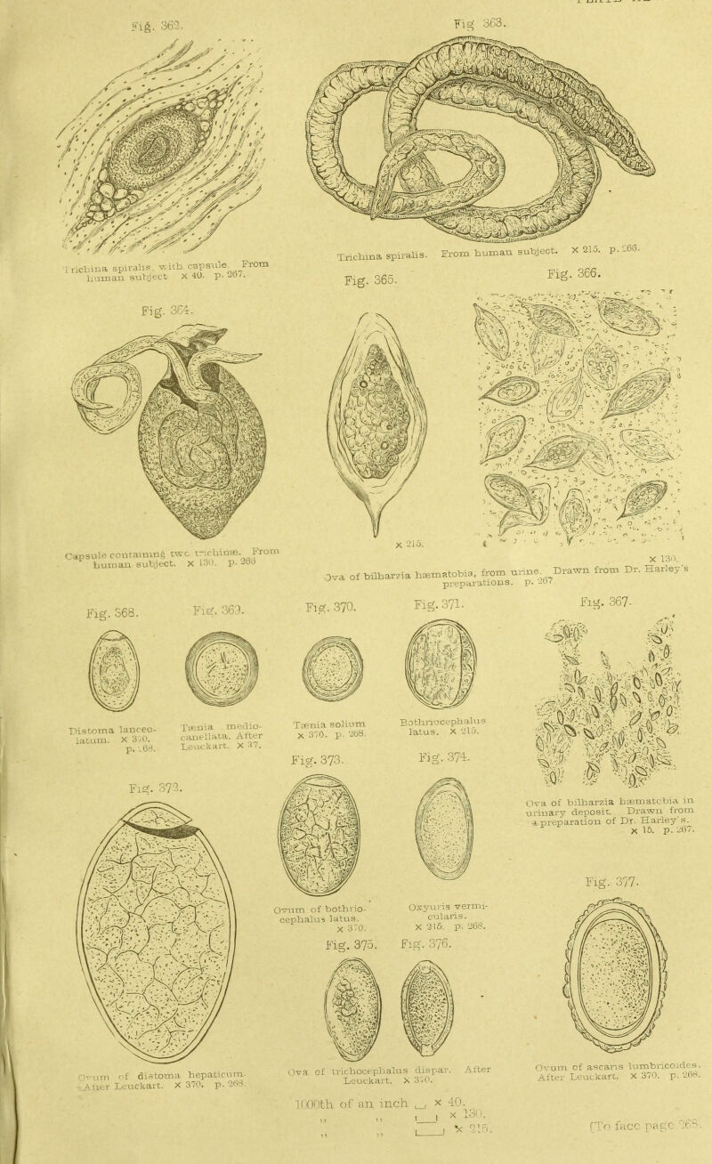 inclaua spirahe, v.ub cai^sule^ From humau subject X 40. p. 20/. Fig. 364 Tncbma spiralis. From Human subject. X215. p.-OO. Fig. 365. Fig. 366. Capsule containing two trichinae. From human subject. X 130. p. 26d X 130. .3va of bilbarzia hsem.tob.n. from nrxne Drawn from Dr. Harley's pifpHrj.tions. p. 2d7 Fig. 368. Fig. 369. Fig. 370. Fig-371. Fig. 367- ■0^ Pistoma lanceo- T«nia medio- latum. X3,0. canellata. After p.-b--!. Leuckart. X-i i. Taenia solium X 370. p. 2b8. Fig. 373. Bothri'oceph alus latus. X 210. Fig. 374- Fig. 373. mmt Ova of bilharzia hpematobia in urinary deposit. Drawn from * preparation of Dr, Harley's. X 15. p. 267. Fig. 377. Ovum of bothrio- cephalus latus. X 3;o. Oxyuris vermi- cularis. X 215. p. 26^. Fig. 375. Fig. 376. ■-i^-um of aistoma hepaticum- Alter L.;-uckart. X 370. p. 268, Ova of trichocephaltis dispar. After Leuckart. X 310. IDODth of an inch X 40. X 13i' Ovum of ascaris b-imbricoidey. After Leuckart. X 370. p. 26.^. rTr> face pfigc '''^6S.